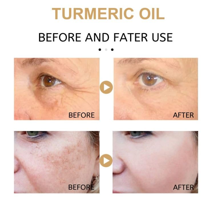 Annma Pure Turmeric Oil - 100% Natural Ayurvedic Essential Oil for Face & Body Care | Skin Brightening, Anti-Aging Turmeric Serum for Women | 30ml (Pack of 2) | Perfect for Daily Skincare Routine & Holistic Wellness
