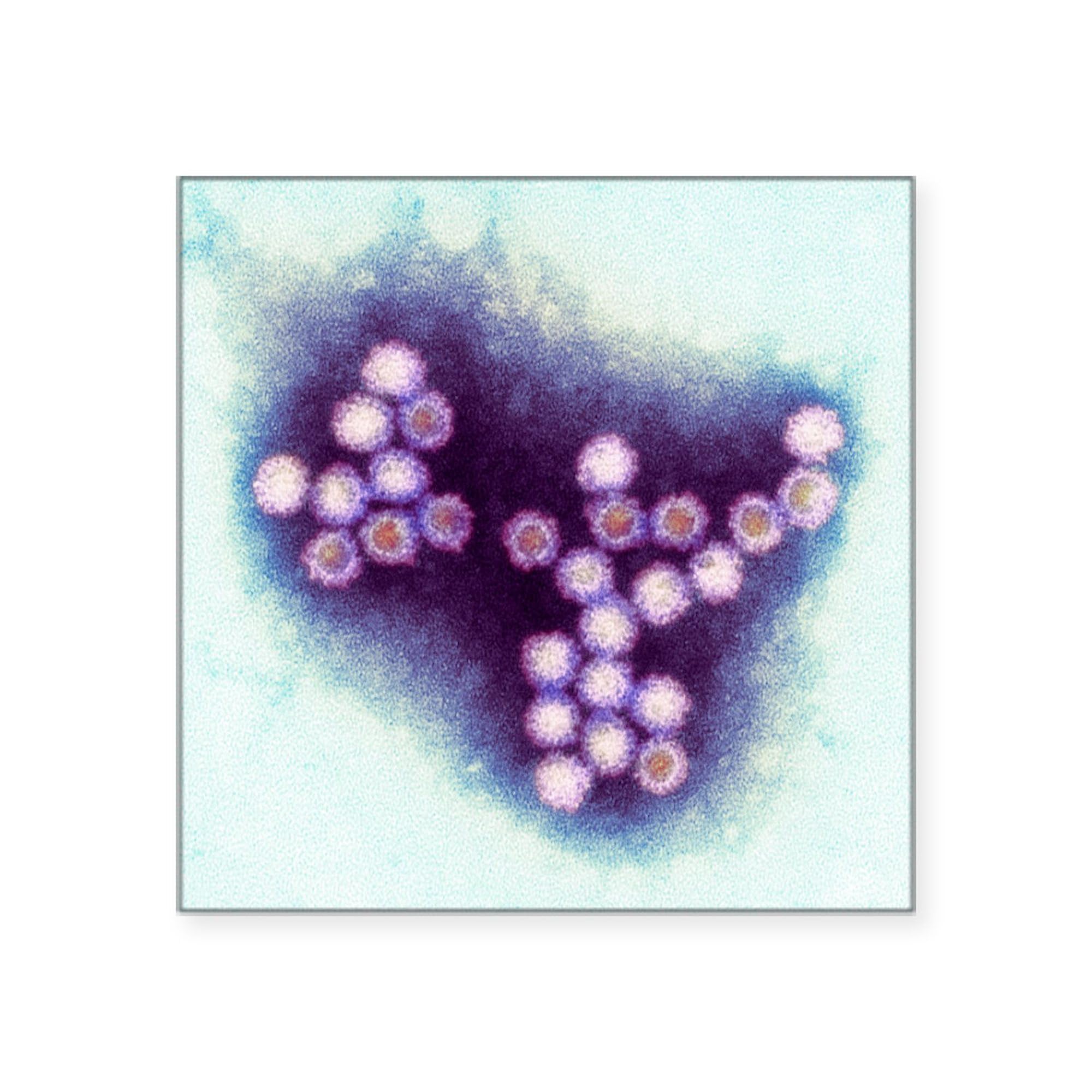 Norovirus Particles TEM Square Sticker - 3x3 Inch Car Bumper Decal | Durable Vinyl for Cars, Laptops & Water Bottles | Perfect for Science Enthusiasts & Medical Professionals