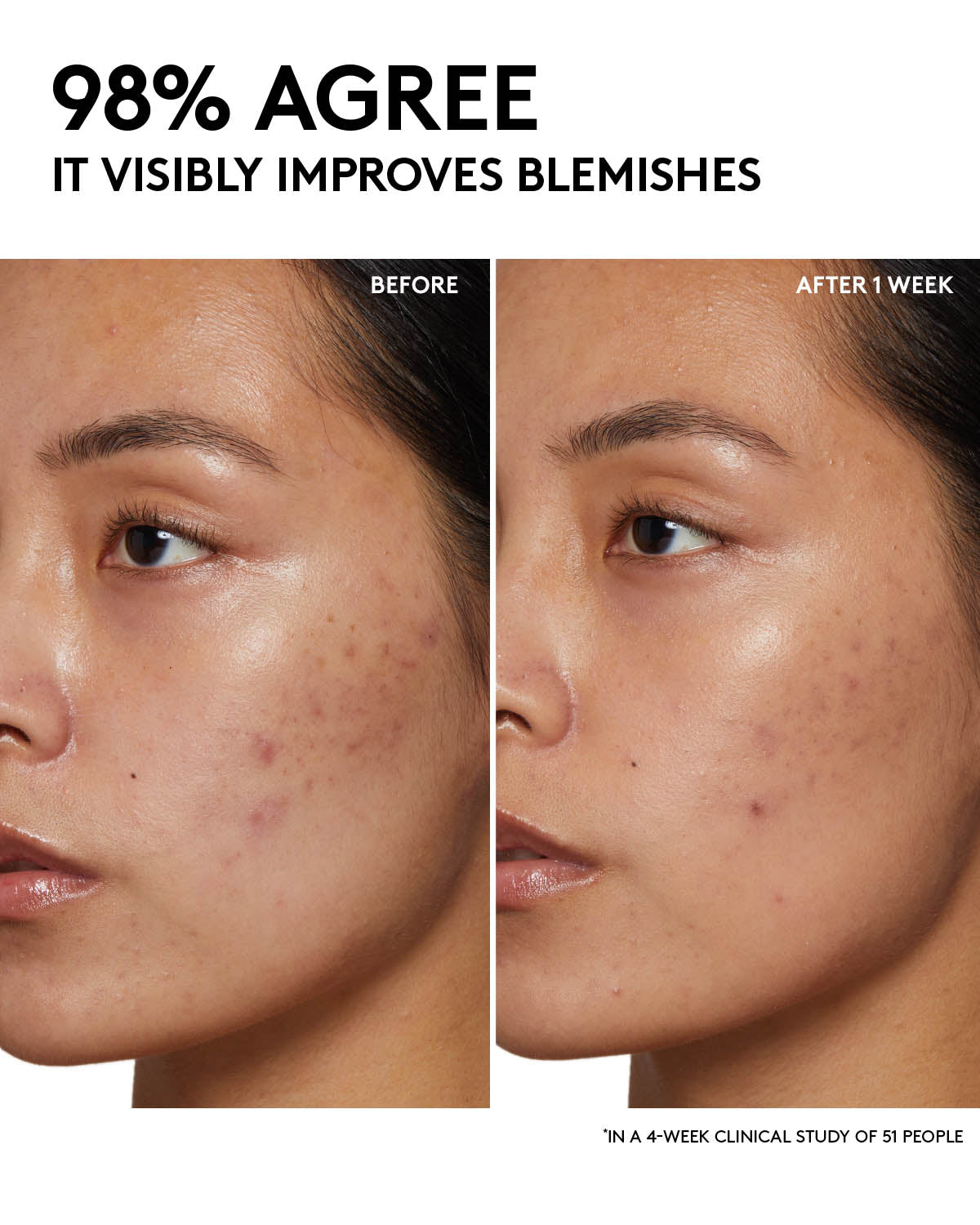 Niacinamide & Aloe Juice Cherry Dub Pore Purifying Gel Cleanser - Deep Cleansing for Oily & Acne-Prone Skin | Perfect for Daily Skincare Routine