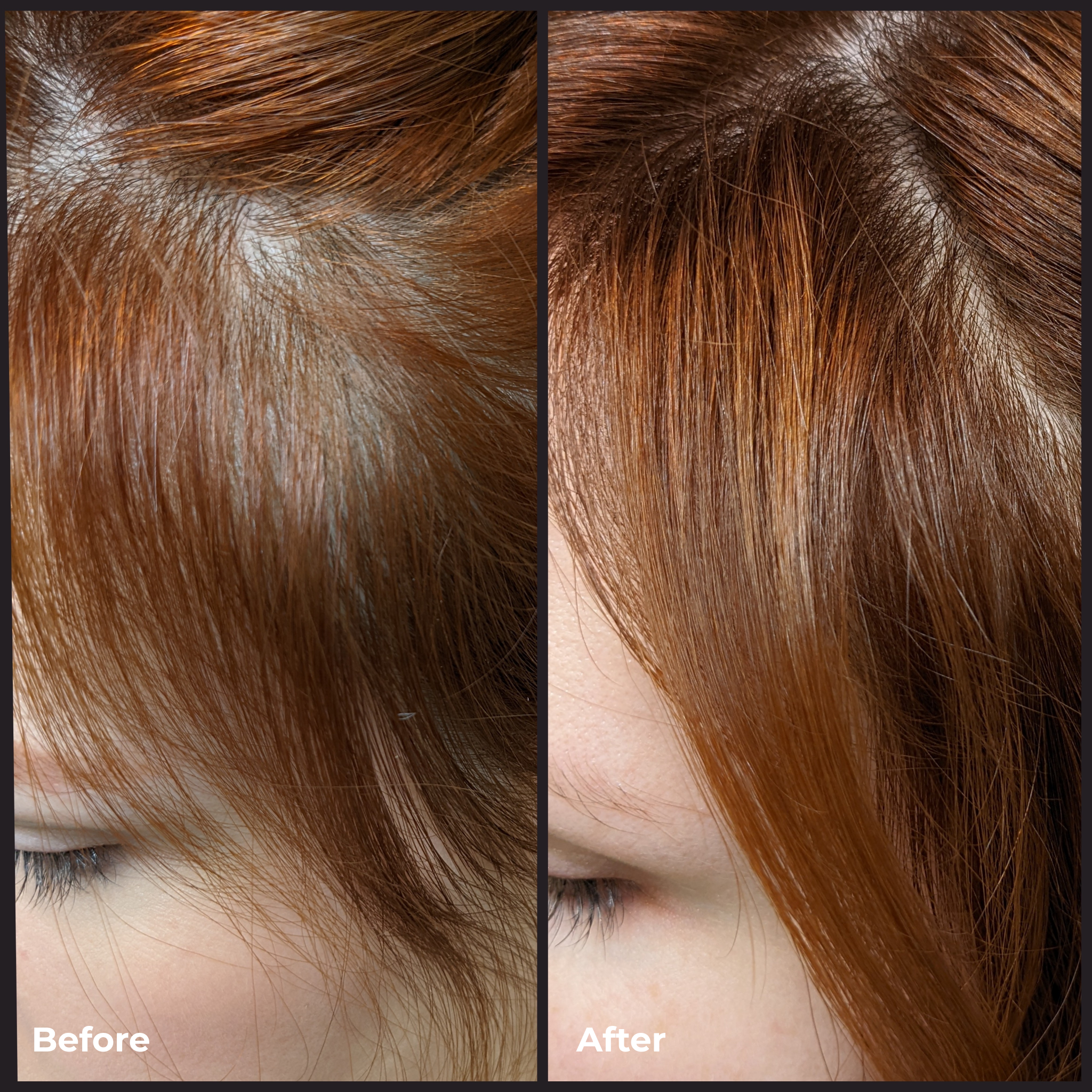 Better Roots RootBoost Serum - Hair Growth Treatment for Thicker, Fuller Hair | Natural & Organic Formula | Perfect for Thinning Hair & Scalp Health | Use Daily for Best Results
