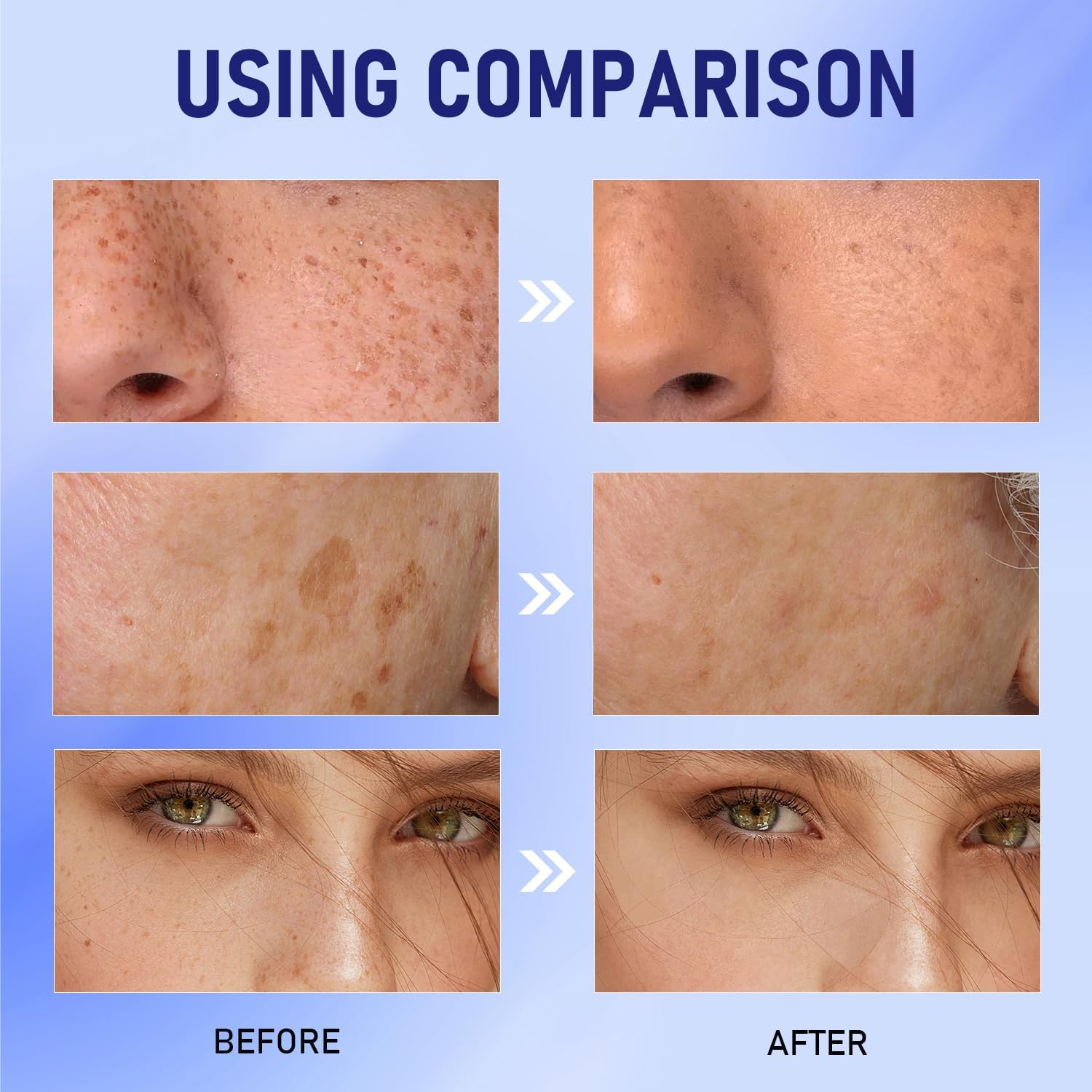 Spot Lightening Urea Cream with Vitamin E - Anti-Aging Wrinkle Reducer, Dark Spot Corrector & Skin Brightener for Face - Hydrating & Nourishing Skincare Treatment (2 Pack) - Perfect for Night Routine & Hyperpigmentation Care