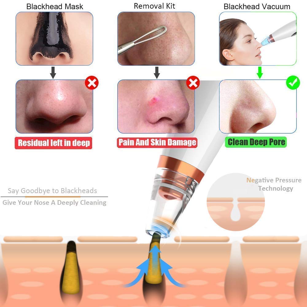 DOZERA Professional Acne Treatment Kit - Blackhead & Pore Vacuum Cleaner, Pimple Extractor Tool for Clear & Smooth Skin | Perfect for Home Facial Care & Daily Skincare Routine