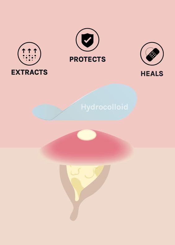 Hydrocolloid Acne Pimple Patch - 72 Dots | Fast Healing Spot Treatment for Zits, Blemishes & Breakouts | Vegan, Cruelty-Free Skincare | Face Care for Overnight Healing | Perfect for Teens & Adults with Acne-Prone Skin