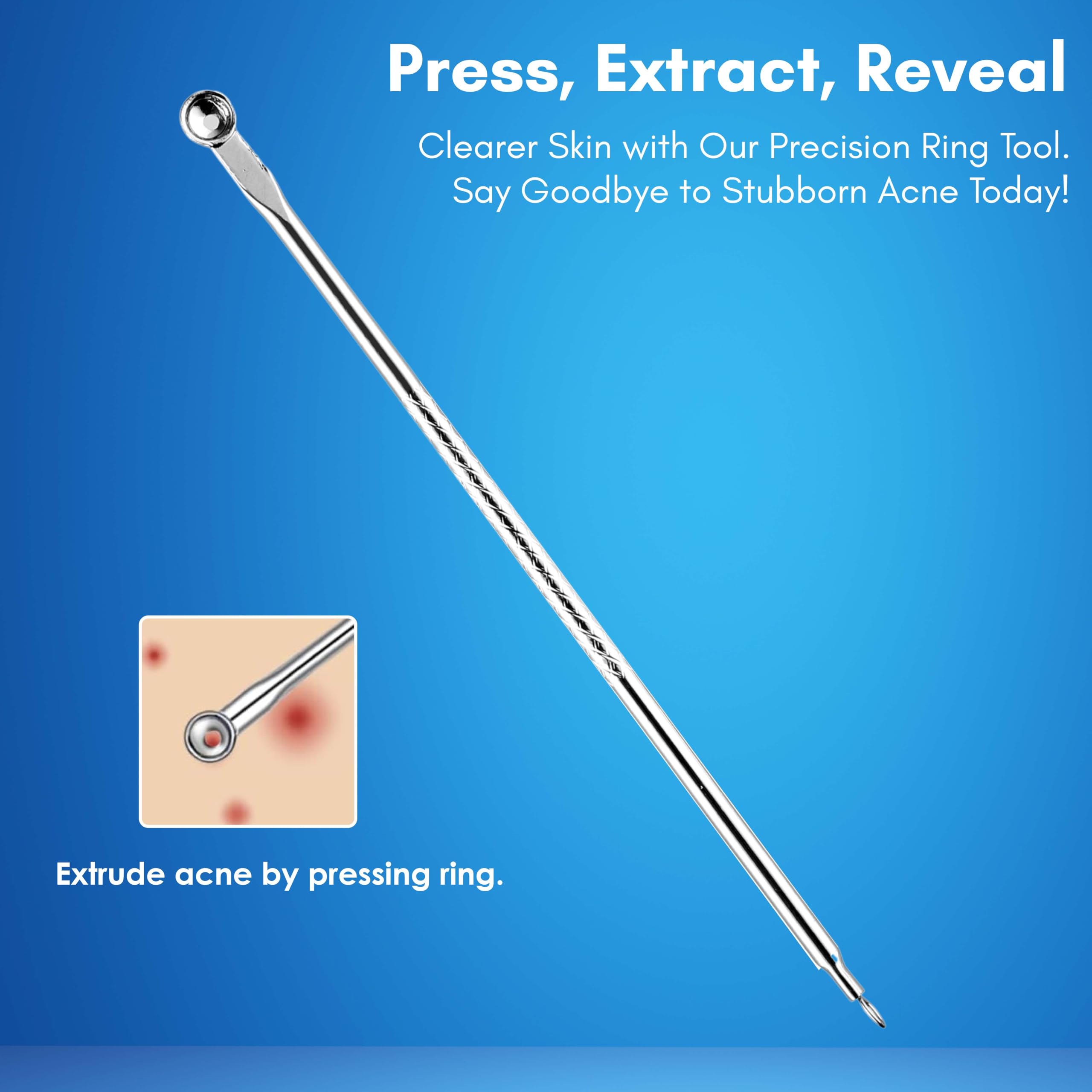 Beauté Secrets Acne Extractor Kit - Professional Blackhead Tweezers & Pimple Popper Tool Set for Ingrown Hair & Facial Impurities Removal - Perfect for Home Skincare & Spa Treatments