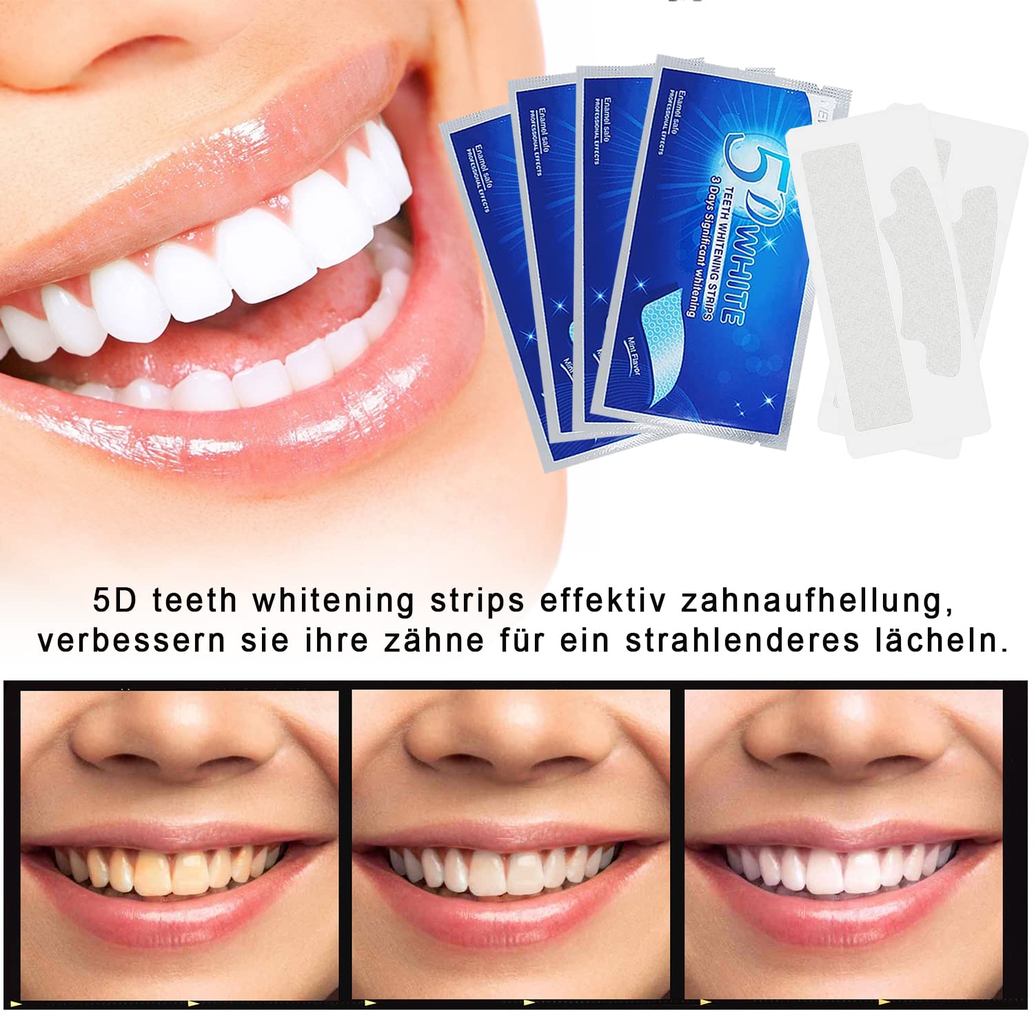 Professional Teeth Whitening Strips for Effective Stain Removal - Brighten Smile at Home | Fast & Safe Dental Bleaching for Coffee, Wine & Smoking Stains