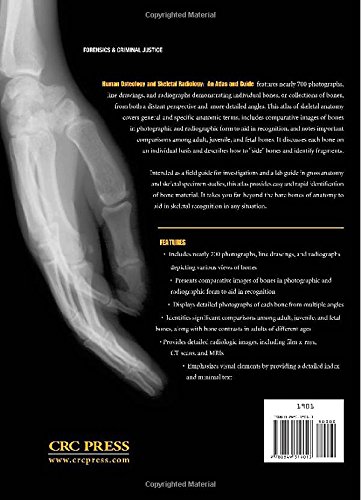 Human Osteology and Skeletal Radiology Atlas - Comprehensive Bone Structure Guide for Medical Students & Professionals | Ideal for Anatomy Study, Forensic Analysis & Clinical Diagnosis