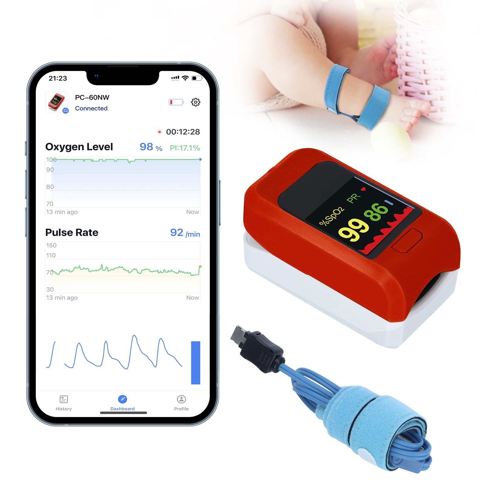 Bluetooth Baby Oxygen Monitor & Pulse Oximeter - Accurate Heart Rate & Oxygen Level Tracker for Infants 0-36 Months with Adjustable Foot Band | Perfect for Newborn Sleep Monitoring & Health Tracking