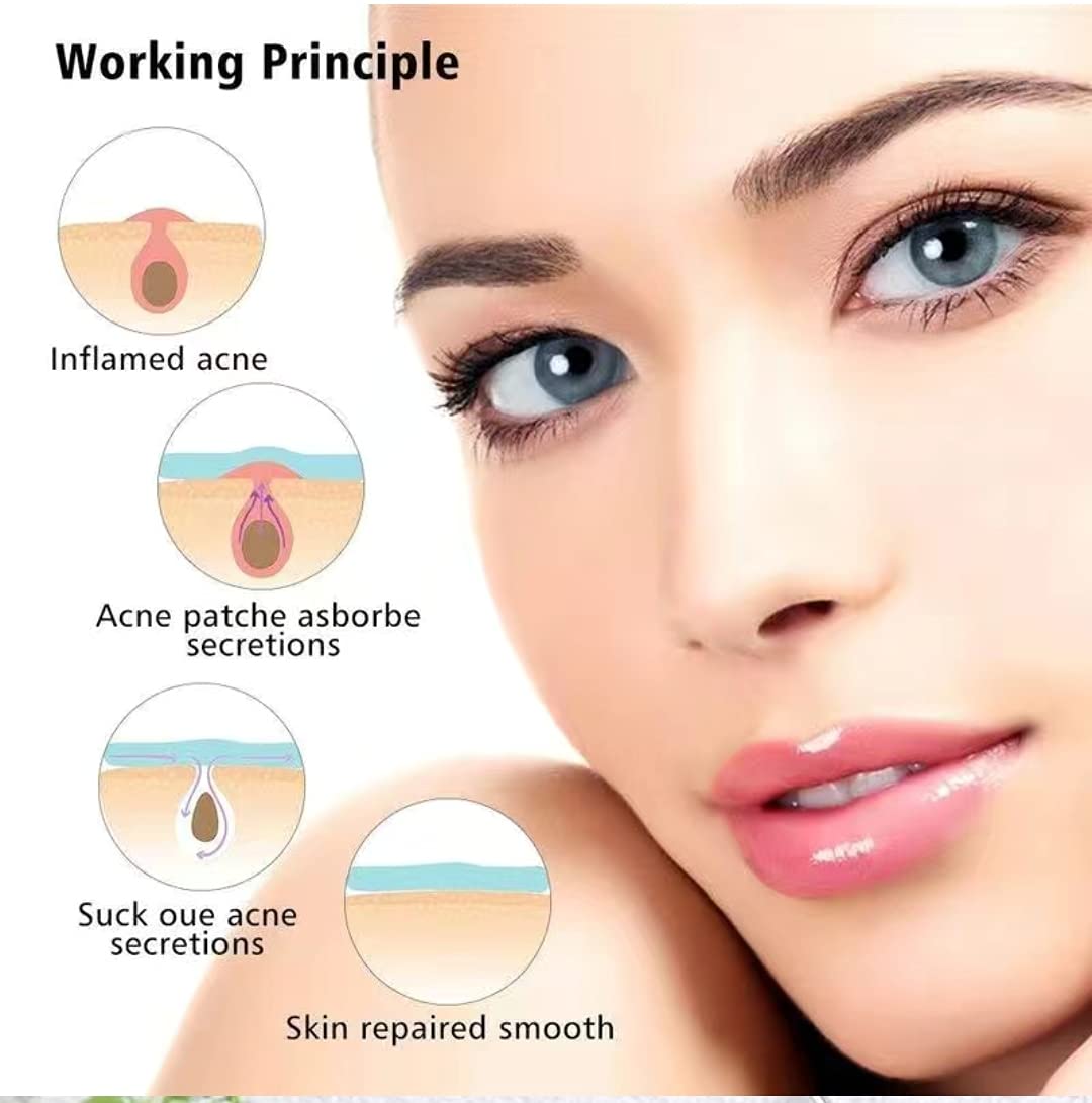 Hydrocolloid Acne Pimple Patches - 108 Count Invisible Absorbing Cover for Face & Skin Care | Spot Treatment for Breakouts, Blemishes & Zits | Perfect for Overnight Use & Daily Skincare Routine