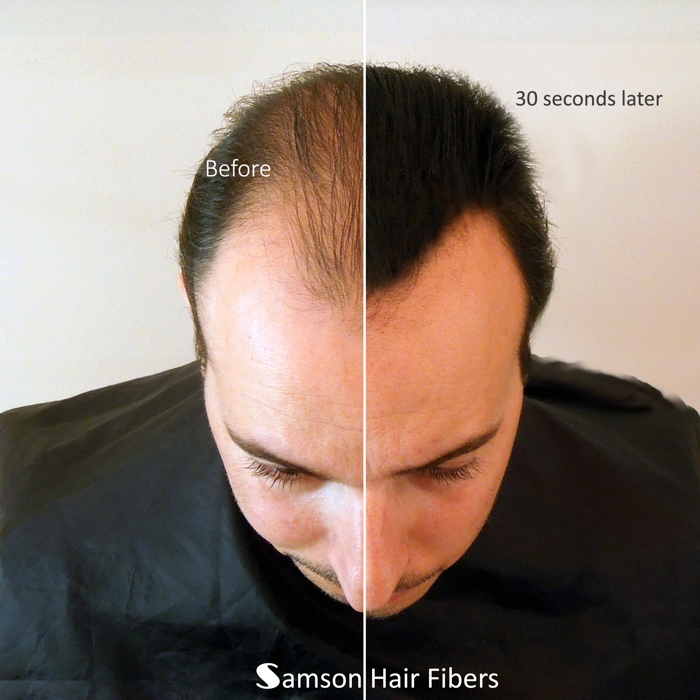 Best Hair Loss Concealer & Thickening Fibers - 1KG Black | USA Made for All Hair Types | Perfect for Thinning Hair, Bald Spots & Daily Styling