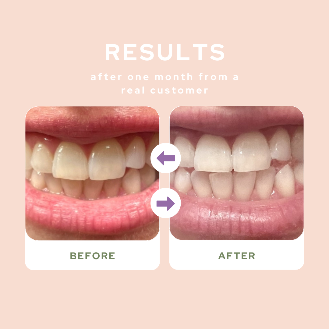 Natural Probiotic Toothpaste for Oral Health - Whitening, Fresh Breath & Cavity Protection - Ideal for Daily Use & Sensitive Teeth