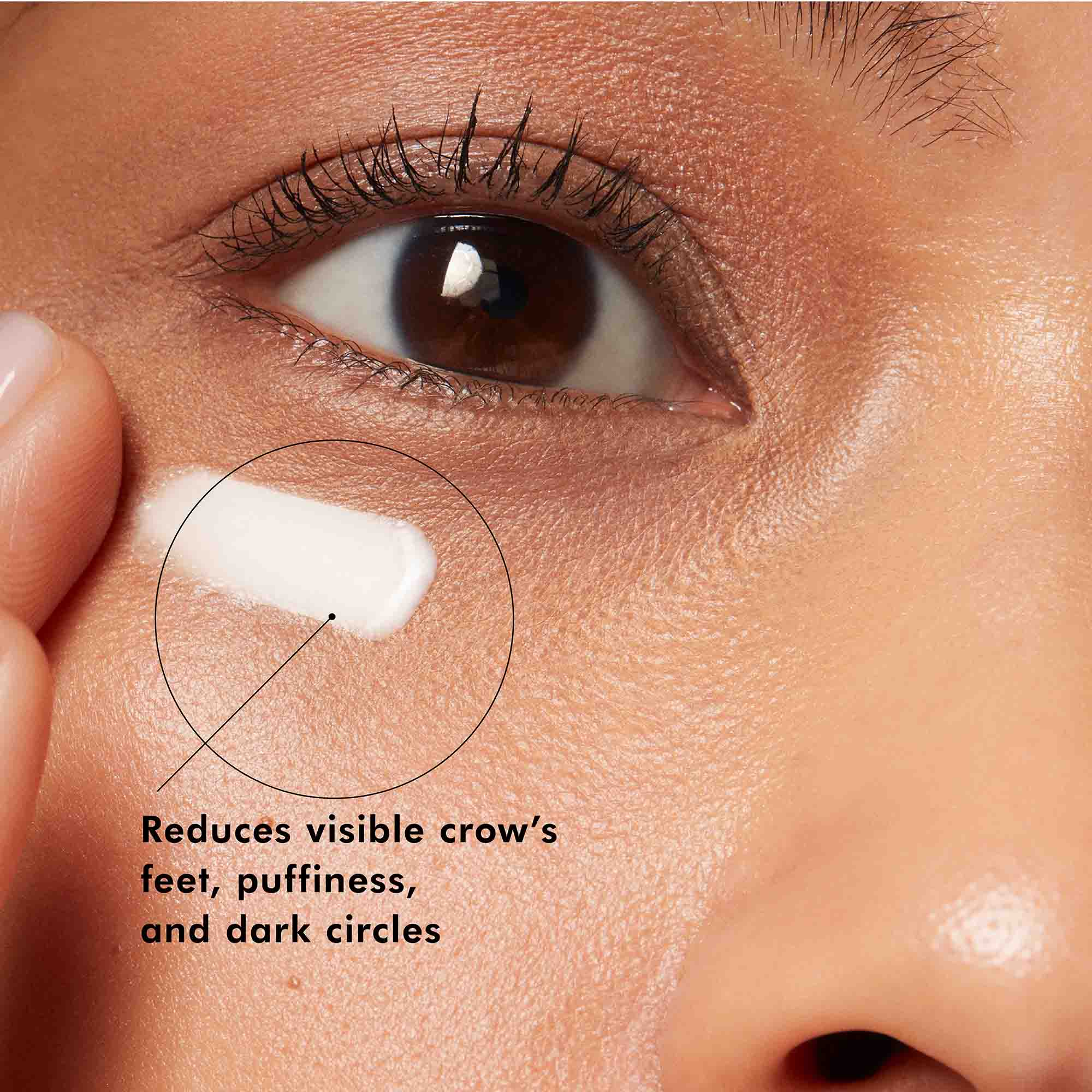 A.G.E. Advanced Eye Cream for Dark Circles & Wrinkles - Anti-Aging Eye Treatment with Retinol & Hyaluronic Acid - Perfect for Night & Day Use - Reduce Puffiness & Fine Lines