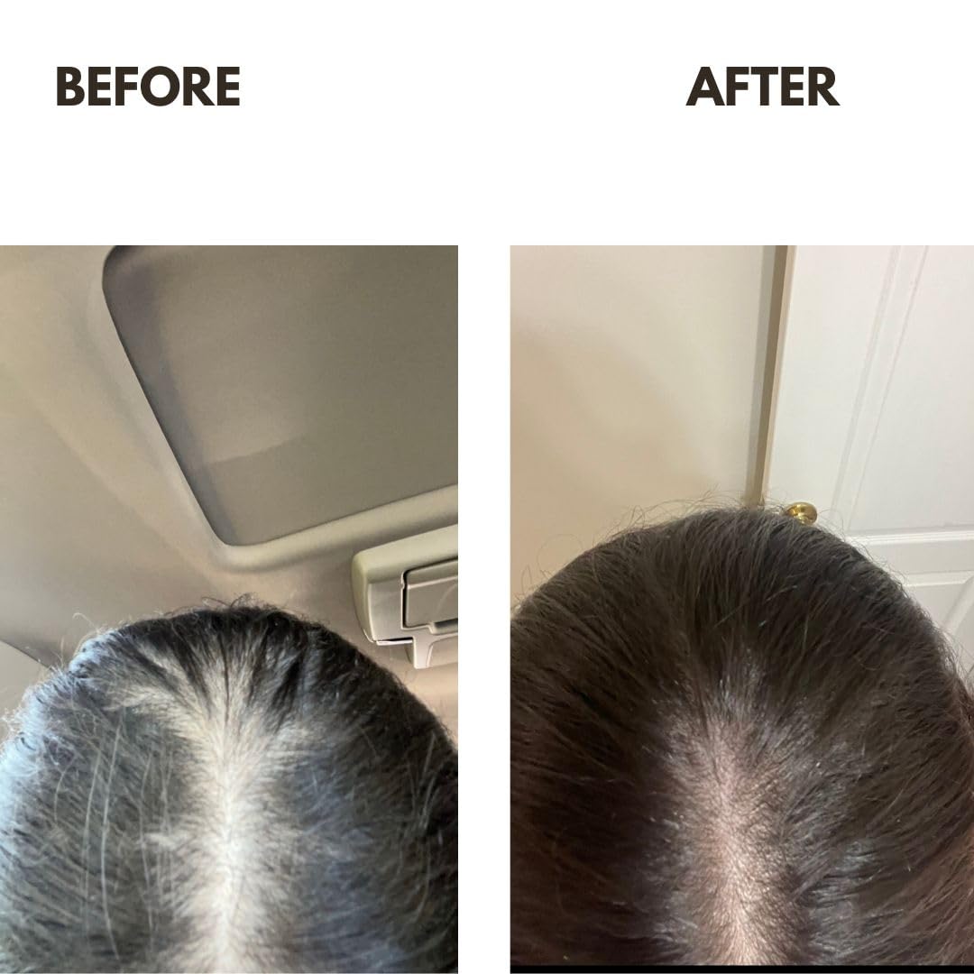 ZAIN1 Natural Hair Growth Shampoo & Conditioner Set with Snail Mucin, Biotin & Rosemary - Stimulating Formula with Niacinamide, Castor Oil, Caffeine & Vitamin E for Thicker, Healthier Hair | Perfect for Daily Hair Care & Scalp Nourishment