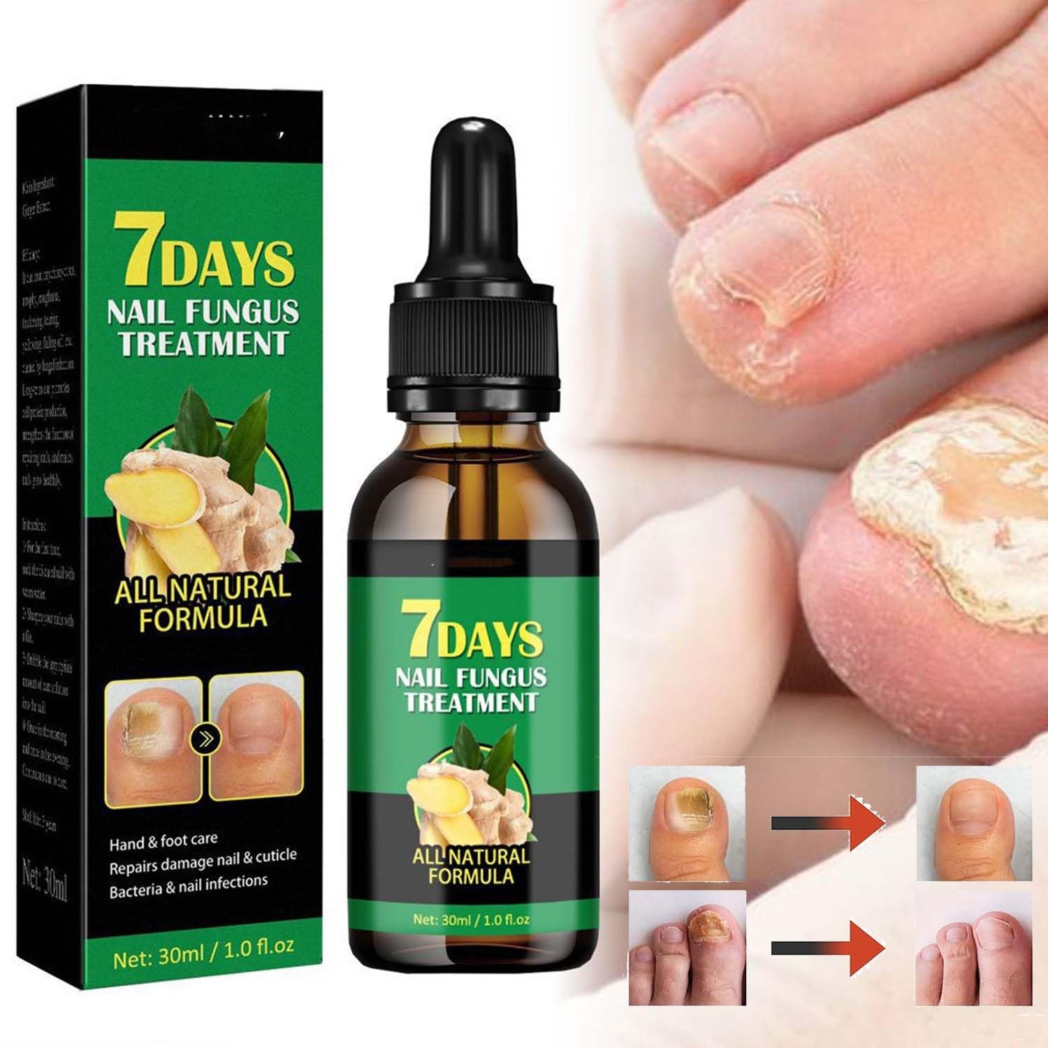 Hola Honey 7 Days Ginger Nail Serum - Natural Nail Growth Treatment & Repair for Strong Healthy Nails - Perfect for Dry Cracked Feet Care & Pedicure at Home