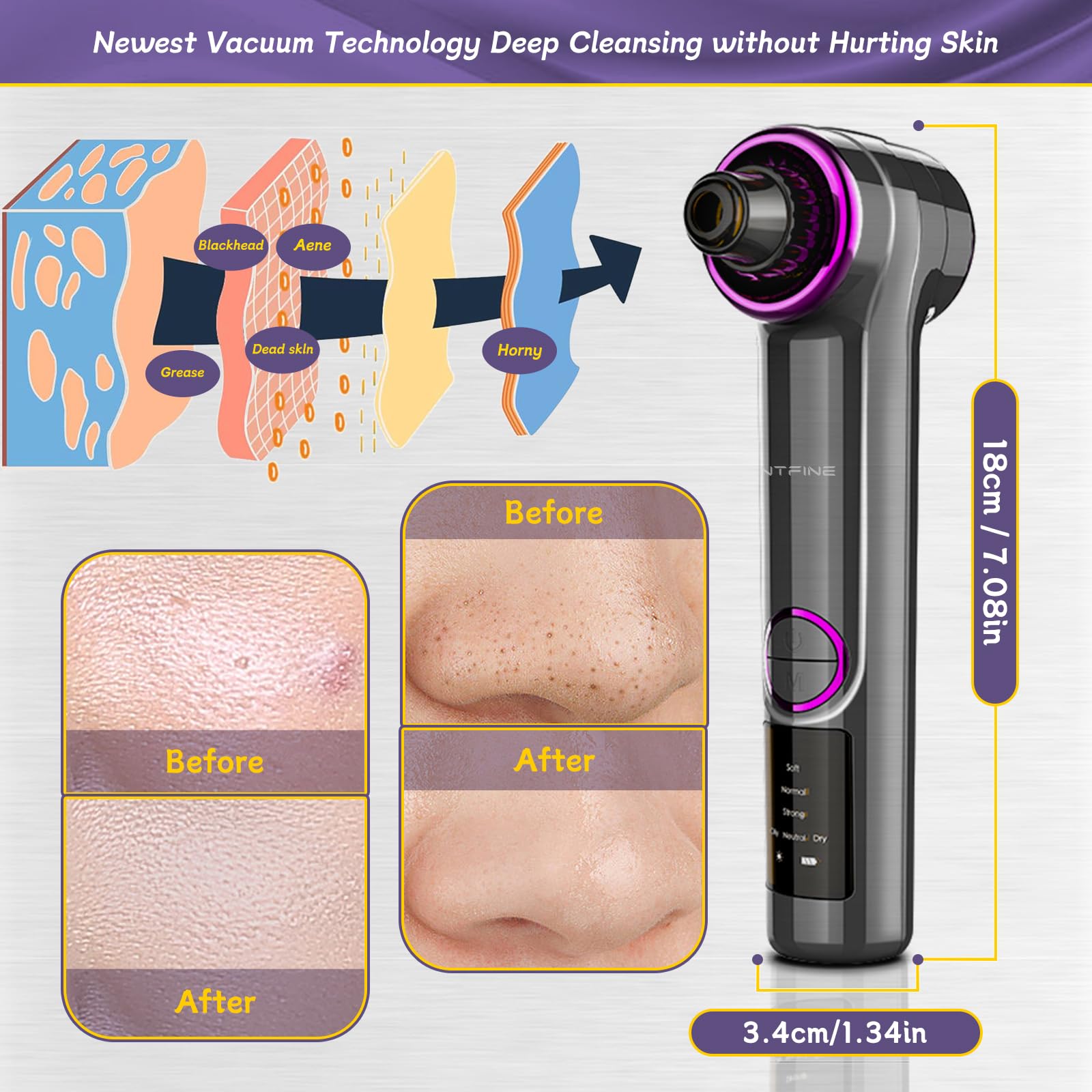 Blackhead Remover Vacuum - 2-in-1 Electric Facial Pore Cleaner with Heating Mode, 5 Attachments & 3 Suction Levels | Professional Comedone Extractor Kit for Deep Cleansing (Grey) | Perfect for At-Home Spa Days & Acne-Prone Skin Care