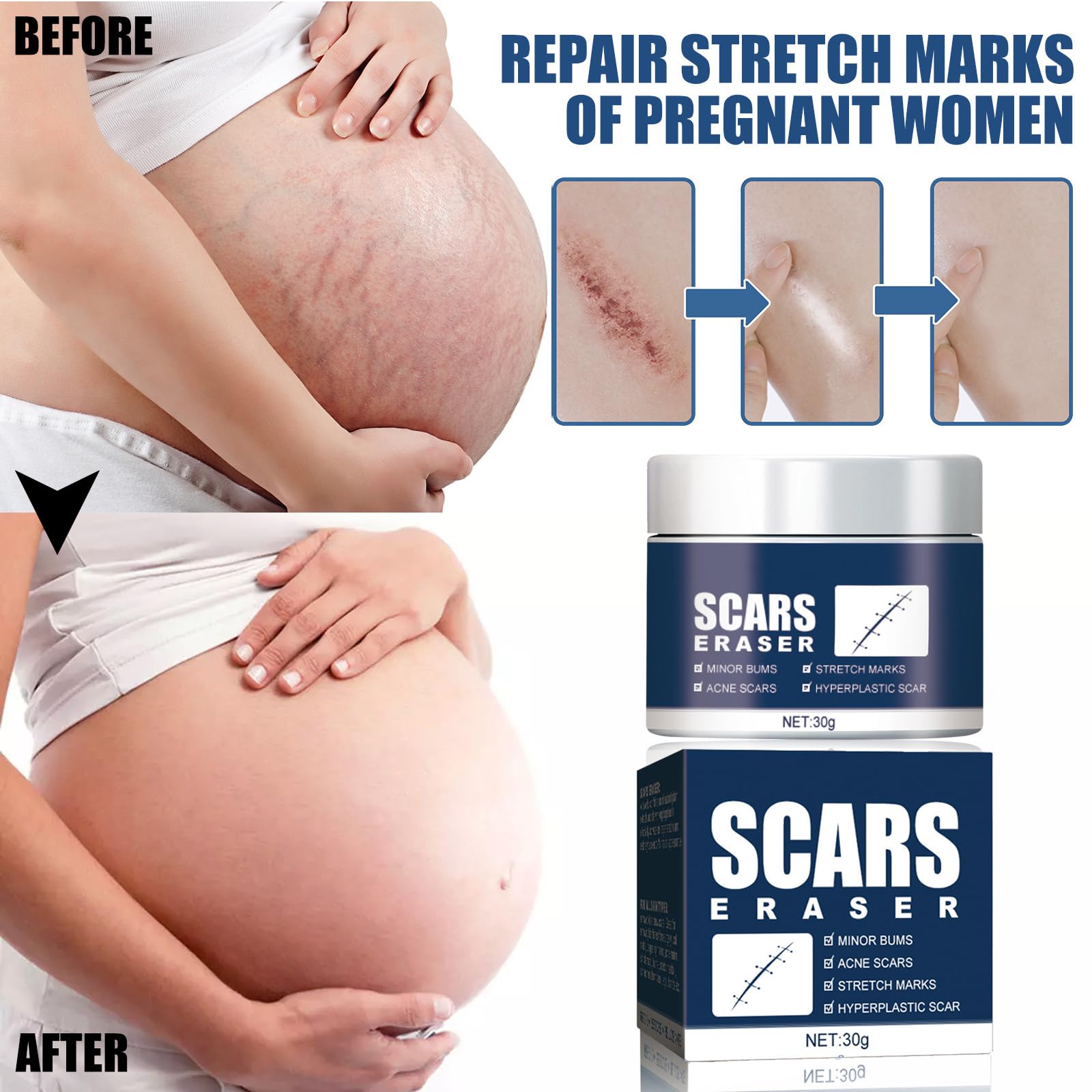 Premium Scar Repair Cream for Face & Body - Medical Grade Scar Removal Treatment for Surgery, Acne, Burns & Injuries - Post-Op Healing Ointment for Smooth Skin Recovery - Ideal for Daily Use After Wounds & Cosmetic Procedures