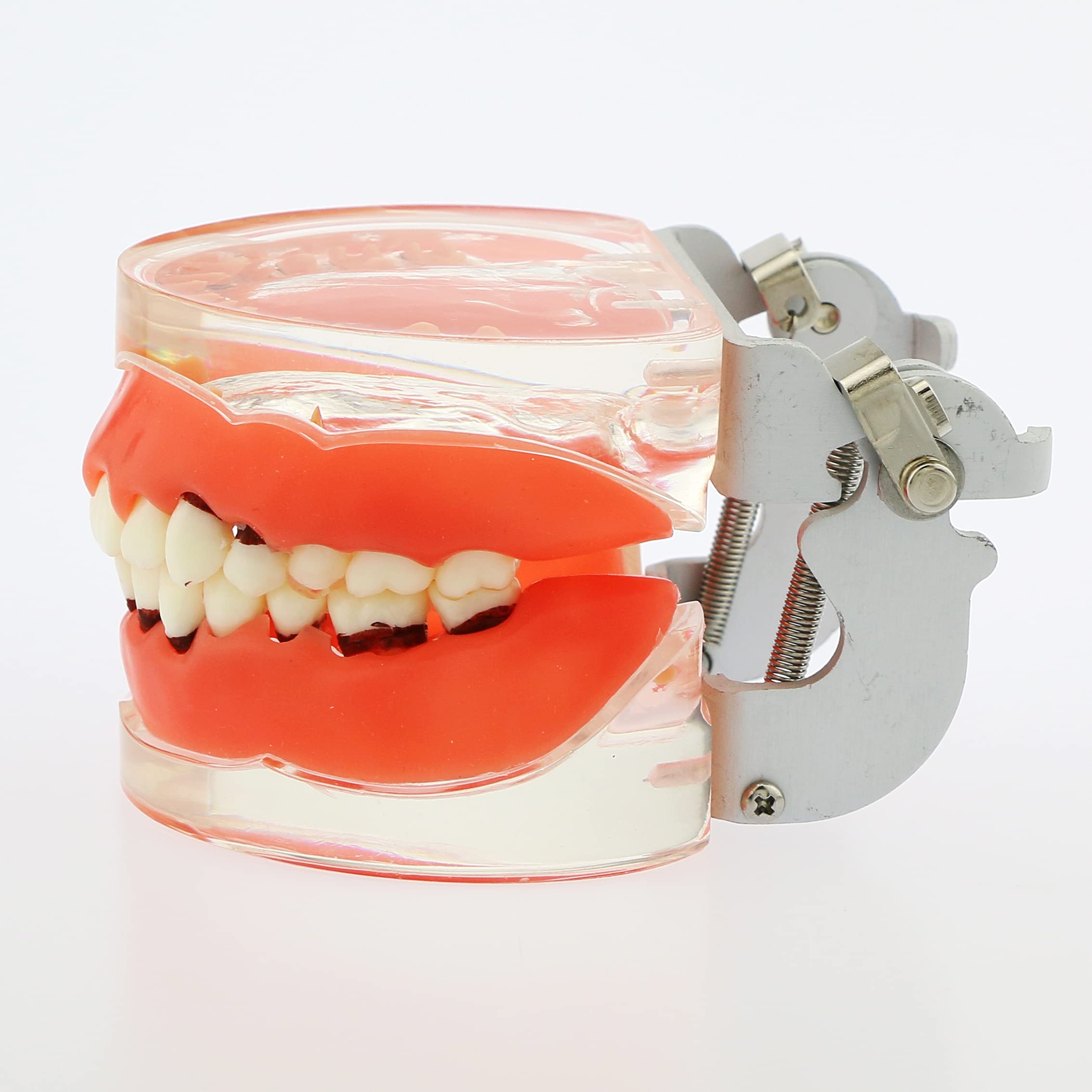 Adult Transparent Dental Teeth Model - Removable Gingivae for Pathology Study & Teaching - Perfect for Dental Students, Dentists & Medical Professionals
