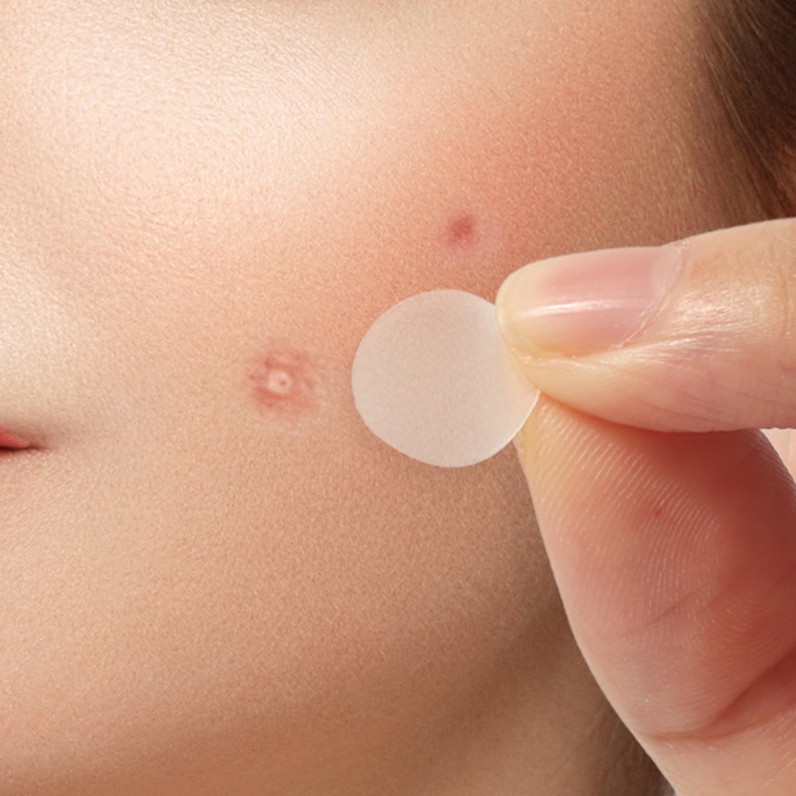 SUMLIVING Acne Patches 180 Count - Invisible Pimple Stickers for Face (12mm & 9mm) - Hydrocolloid Spot Treatment for Overnight Healing - Perfect for Teen Skin Care & Blemish Cover