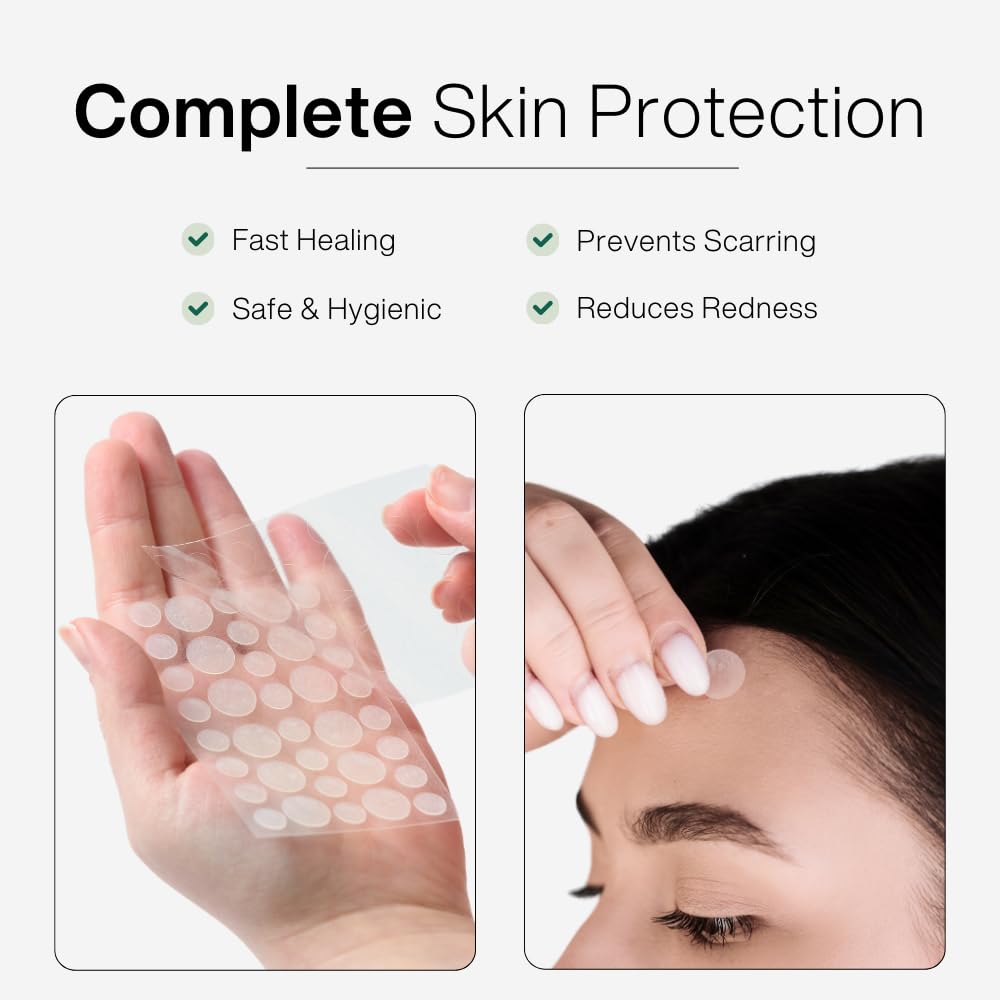 TOTAL ROUTINE Acne Recovery Patch - 72 Count Hydrocolloid Pimple Patches for Overnight Acne Treatment | Waterproof, Invisible Spot Cover for Active Breakouts | Reduces Pimples, Excess Oil & Blemishes | Perfect for Face, Back & Body Care Routine