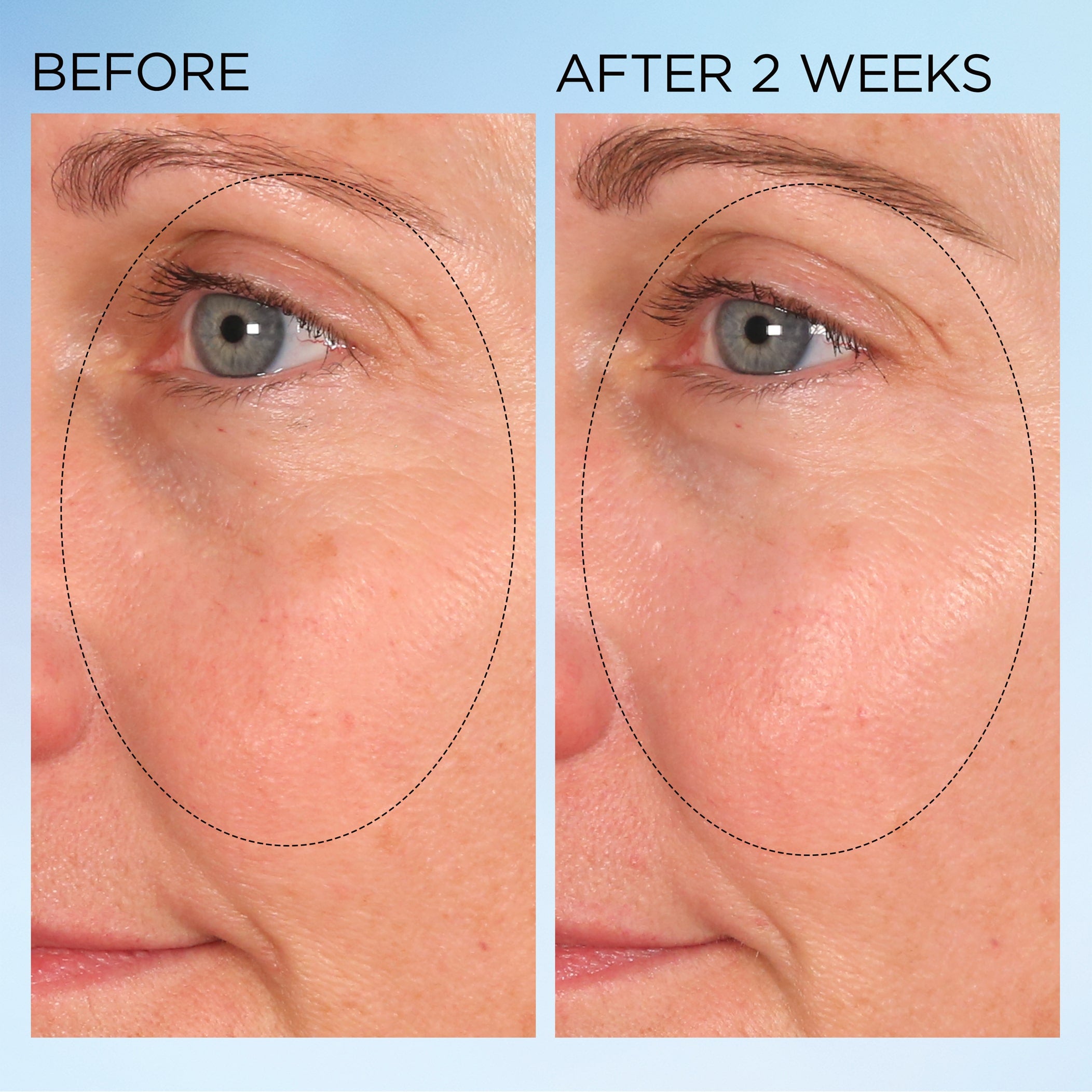 Visible Brightening Clearly Radiant Spot Correcting Capsules 120 Count - Dark Spot Treatment for Face & Body, Brightening Serum for Even Skin Tone - Perfect for Daily Skincare Routine & Nighttime Use