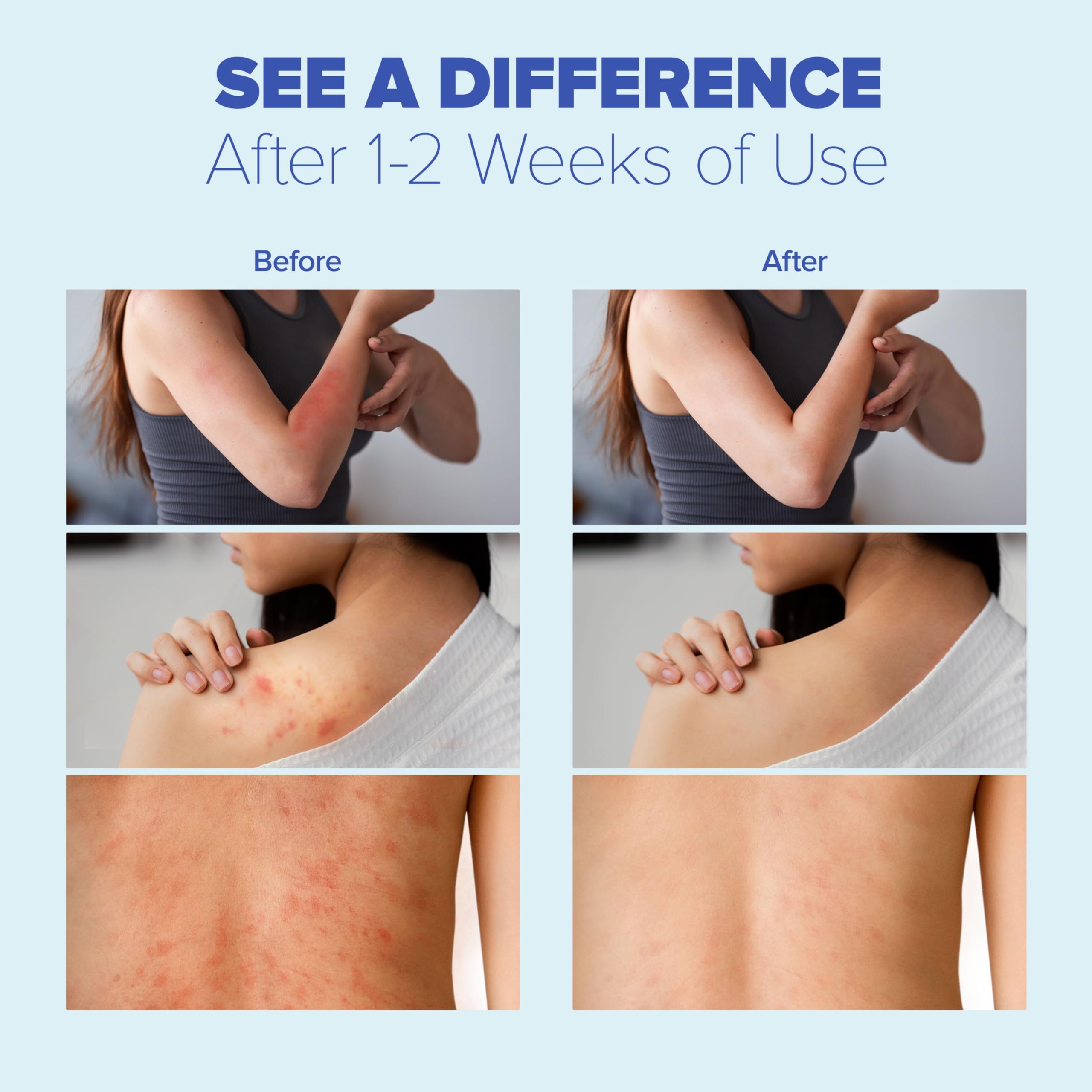 Extra Strength Antifungal Cream for Ringworm, Jock Itch & Athlete's Foot - Fast Itch Relief for Eczema & Psoriasis - Advanced Antifungal Treatment for Skin - 1.7 oz - Perfect for Gym, Sports & Daily Skin Care