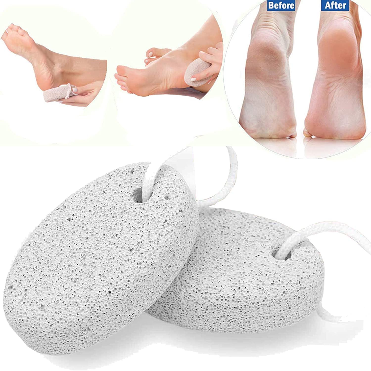 Oval Pumice Stone for Feet - Exfoliating Dead Skin Remover for Men & Women - Perfect for Pedicures, Callus Removal & Soft Smooth Feet at Home