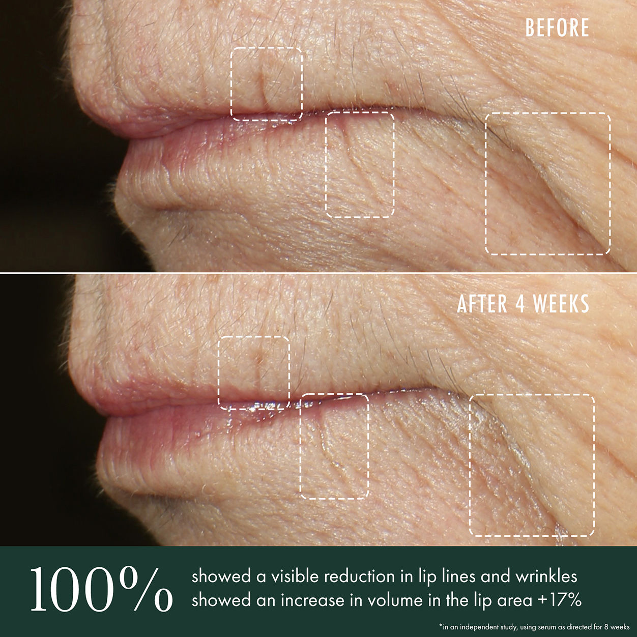 Advanced Lip Perioral Serum - Anti-Aging Vertical Line Filler for Smile Lines & Wrinkles | Perfect for Daily Skincare & Night Routine