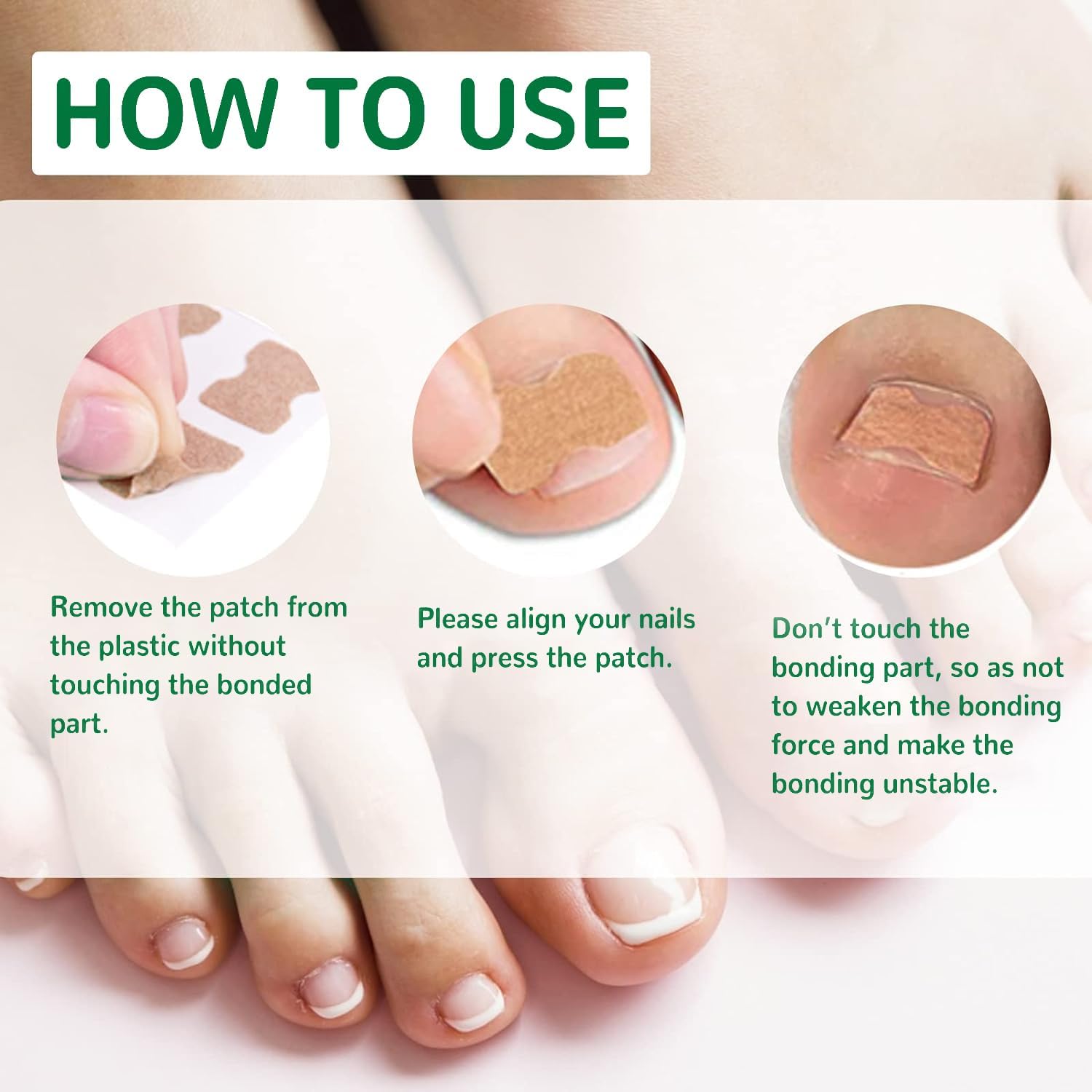 **50 Pcs Breathable Ingrown Toenail Corrector Patches - Painless No Glue Solution for Ingrown Nails, Fast Repair & Stays Secure - Perfect for Athletes, Runners & Daily Comfort**