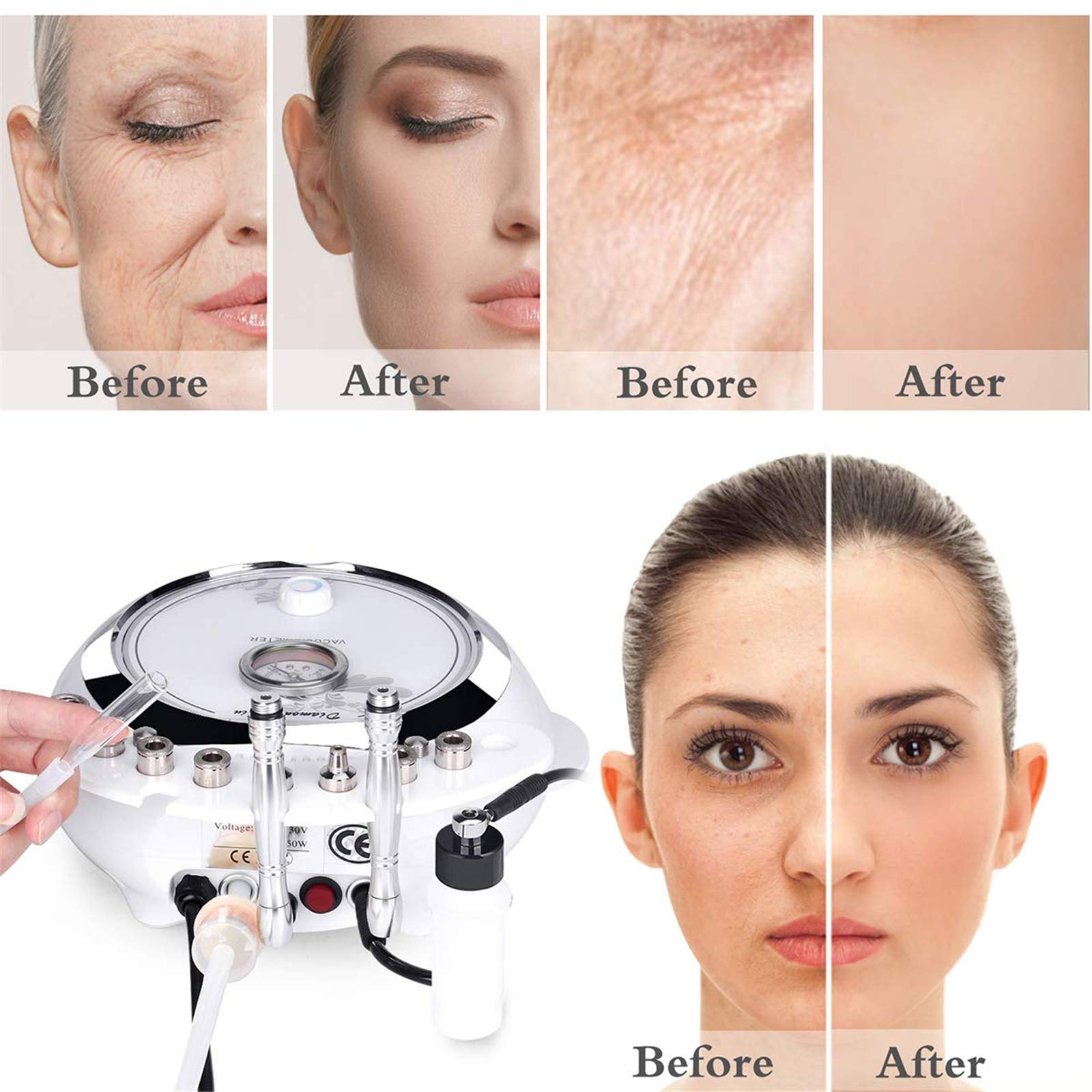 Upgraded 3-in-1 Diamond Microdermabrasion Machine with 65-68cmHg Suction Power - Professional Facial Care Device for Home & Salon Use - Perfect for Exfoliation, Blackhead Removal & Skin Rejuvenation