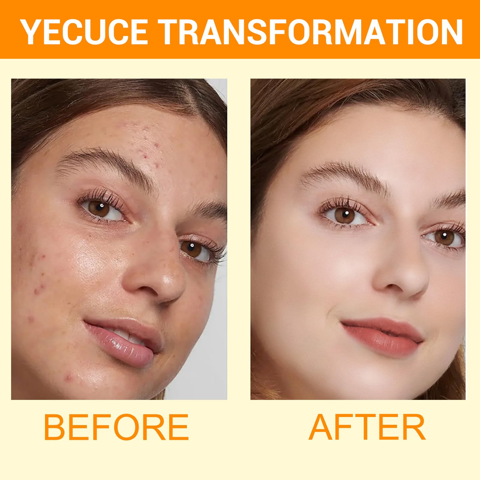 Turmeric & Kojic Acid Facial Cleansing Mousse - Deep Pore Cleanser for Skin Brightening, Firming & Keratin Removal (150ml) | Gentle Face Wash for Daily Skincare Routine & Acne-Prone Skin