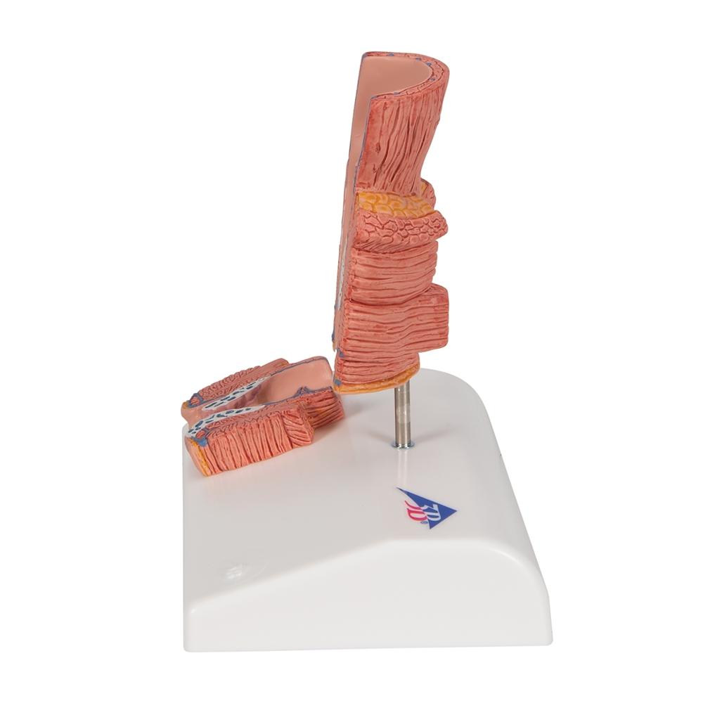 Premium Hemorrhoid Anatomy Model for Medical Training & Patient Education – Ideal for Doctors, Nurses & Healthcare Professionals