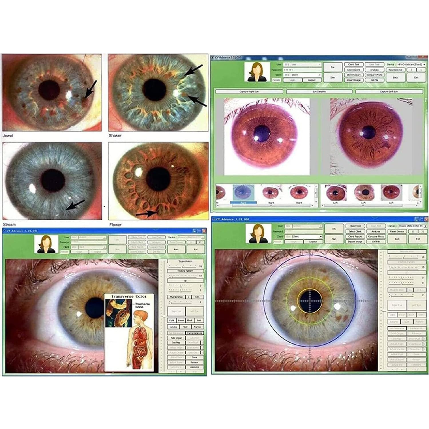 5MP High Resolution Iridology Camera - 2560x1920 USB 2.0 Iris Scanner with 30x HD Lens for Computer Analysis | Perfect for Holistic Health Practitioners & Naturopathic Doctors