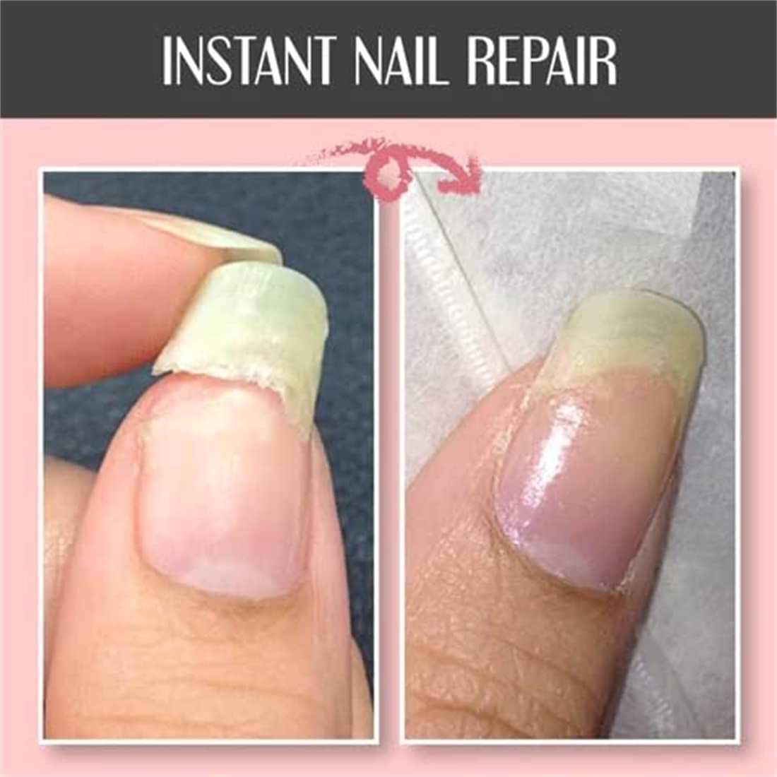 2022 Nail Repair Protection Gel - Strengthening Nail Treatment for Damaged & Brittle Nails, Instant Repair Top Coat Gel (2Pcs) - Perfect for Salon & Home Manicures