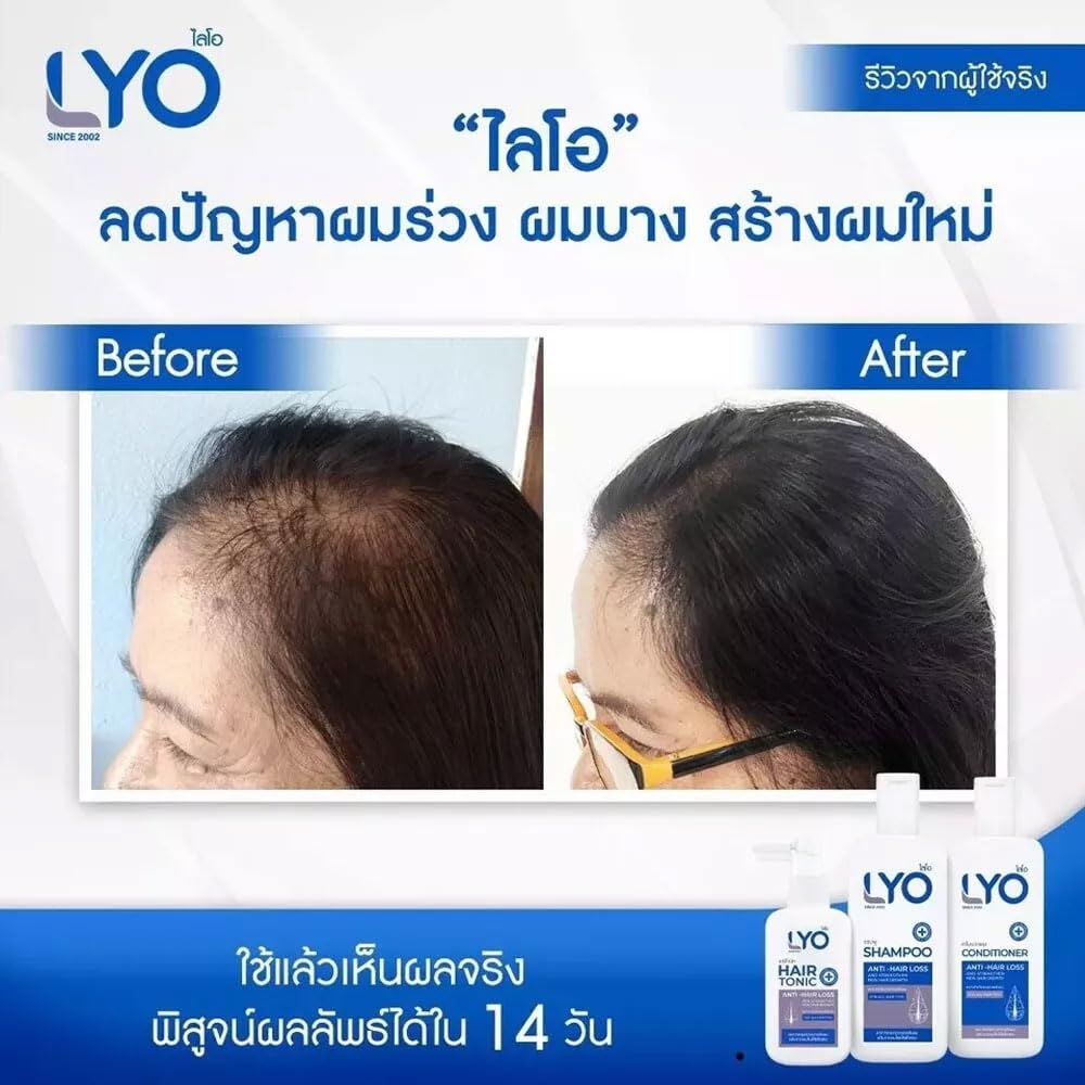 Lyo Shampoo Conditioner Set with Hair Tonic Treatment - Strengthens Hair & Promotes Regrowth for Thicker, Healthier Locks - Perfect for Daily Hair Care Routine & Scalp Nourishment