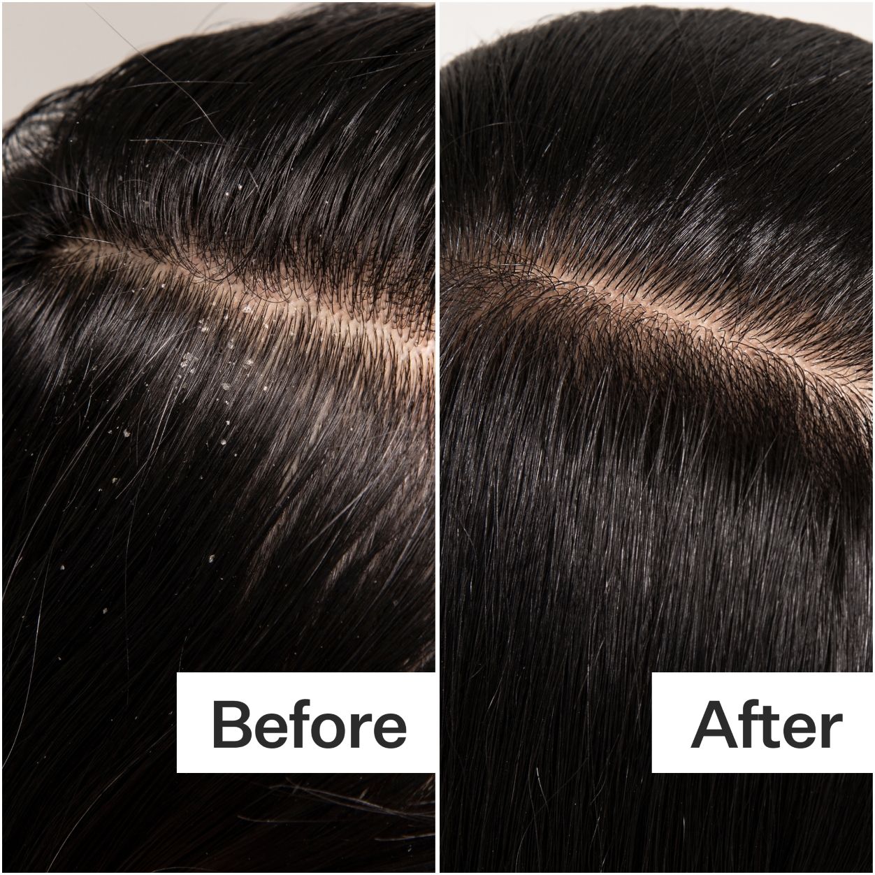 Organic Cold Processed Scalp Detox Shampoo for Dandruff & Itchy Scalp Relief - Natural Hair Care for Dry, Flaky Scalp - Perfect for Daily Use & Sensitive Scalp Treatment