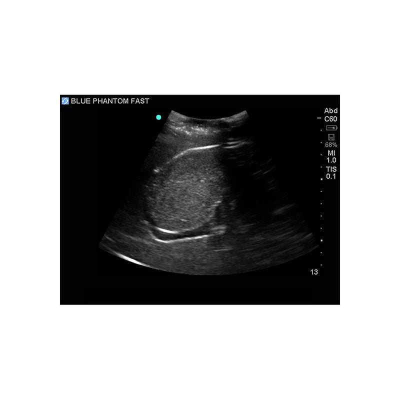 FAST Exam Ultrasound Training Model - Transthoracic & Transesophageal Echo Simulator for Cardiac Sonography Practice (Ideal for Medical Students, Ultrasound Tech Training & Clinical Skills Development)