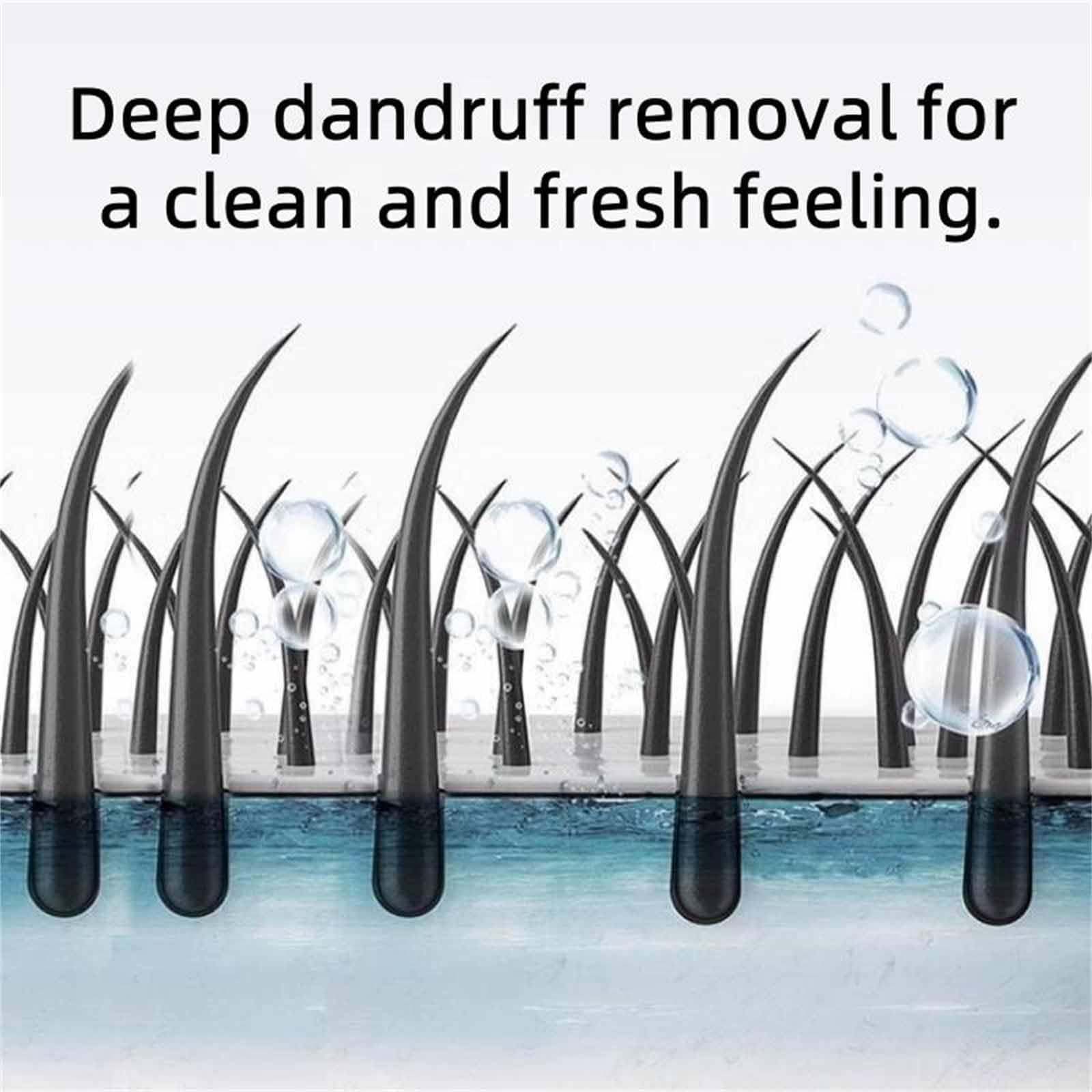 Nipori Anti-Dandruff Shampoo for Men & Women - 300ml Deep Moisture Refreshing Hair Care with Oil Control & Cleansing Formula (2 Pack) - Perfect for Daily Scalp Care & Dandruff Prevention at Home or Gym