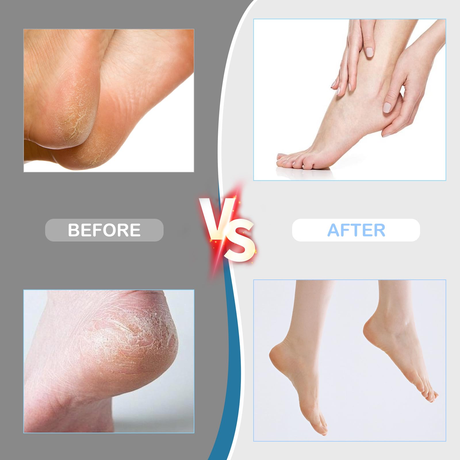 Professional Electric Foot Callus Remover - Adjustable Speed Pedicure Tool with 60 Replacement Sandpaper Discs for Dead Skin & Calluses - Black - Perfect for At-Home Pedicures & Foot Care