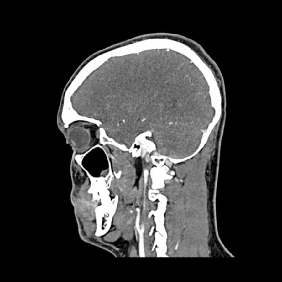 Head and Neck CTA Phantom AVM for CT Scan & X-Ray Training - Medical Imaging Practice, Radiology Education, and Diagnostic Testing