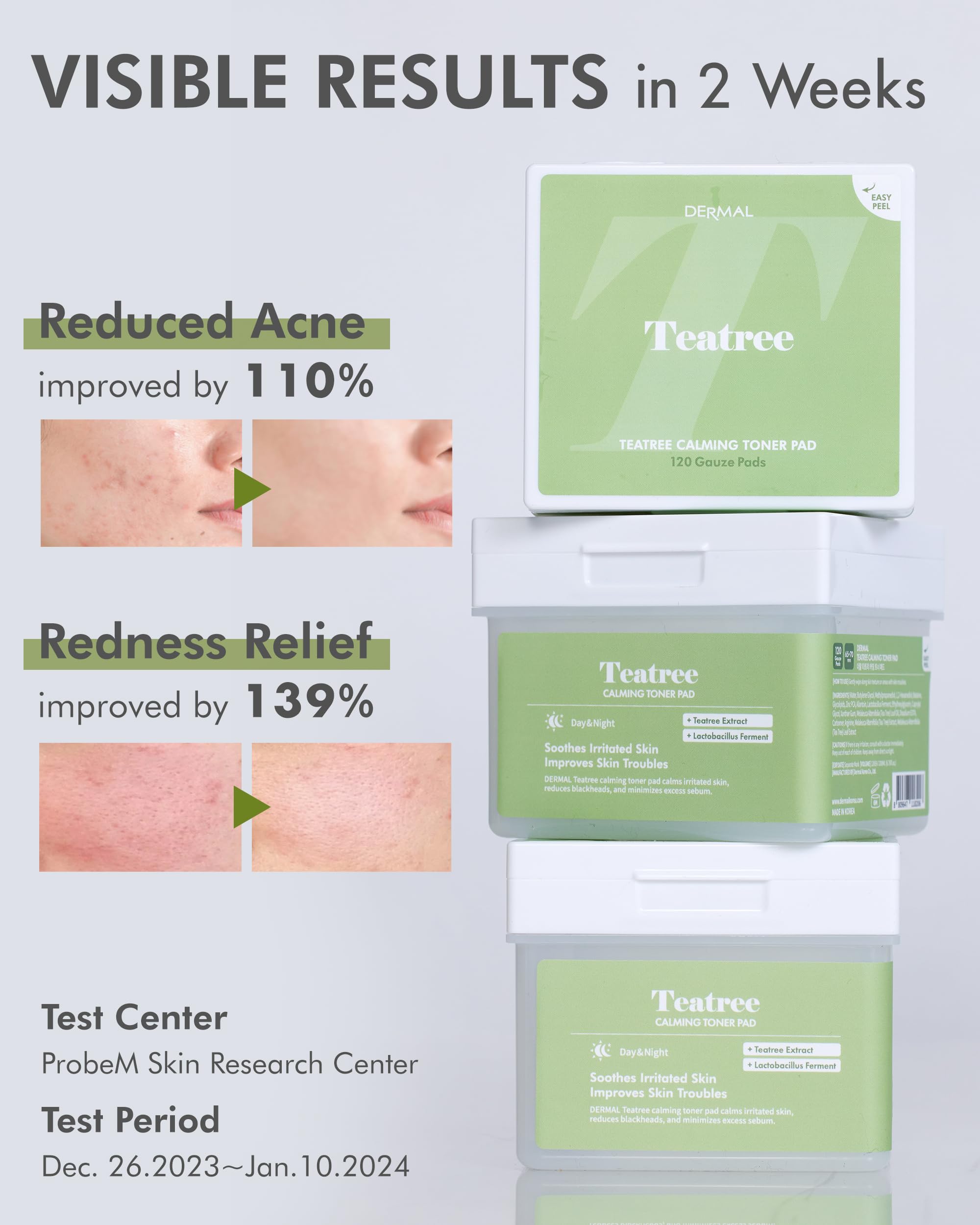 Dermal Tea Tree Calming Toner Pads & Vitamin Toner Pads Travel Kit Set - Soothing Acne Treatment for Oily & Sensitive Skin | Perfect for Travel, Gym & On-the-Go Skincare