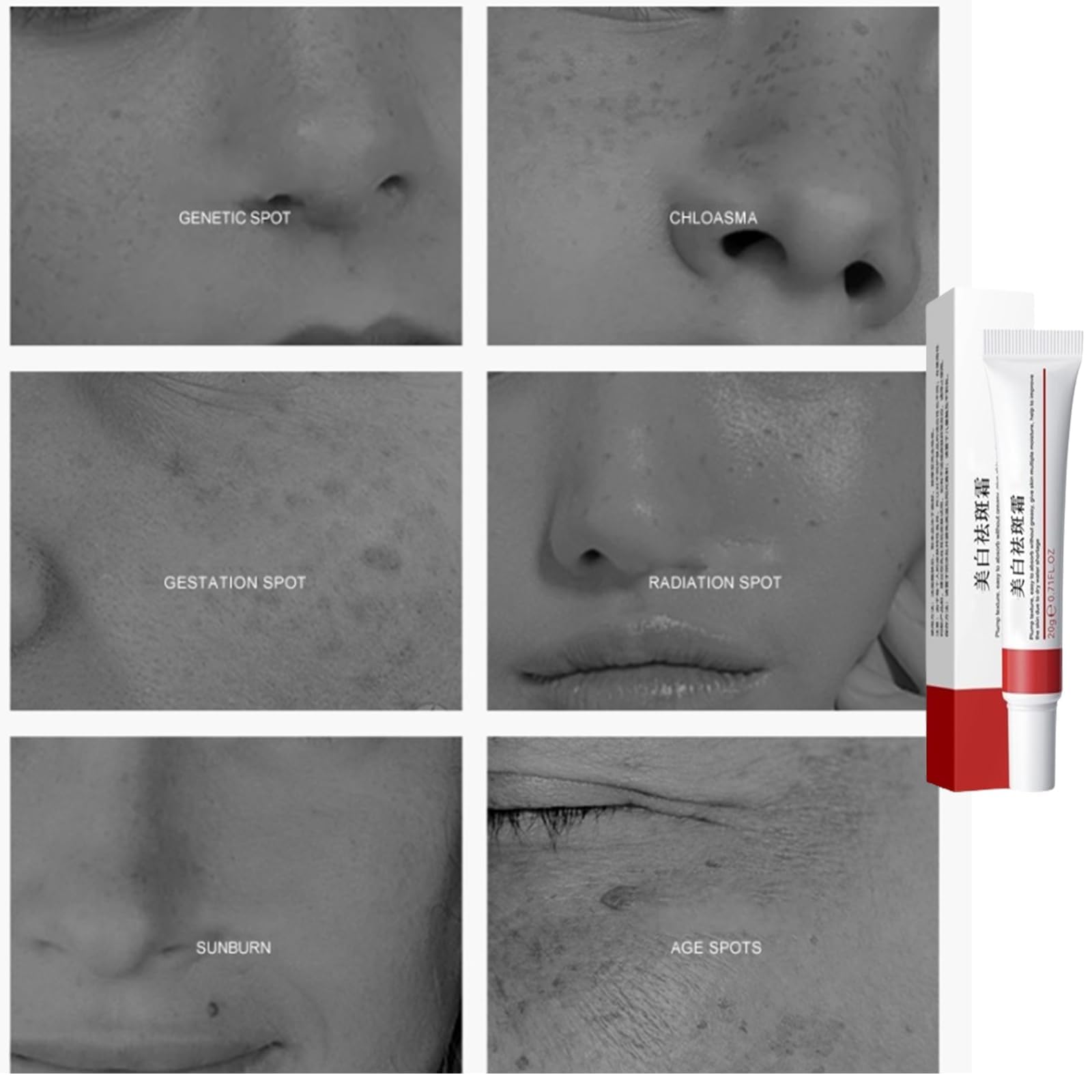 Achromin & Pigmanorm Cream - Brightening Face Moisturizer for Dark Spots & Hyperpigmentation - Multi-Purpose Skin Care Treatment for Day & Night Use