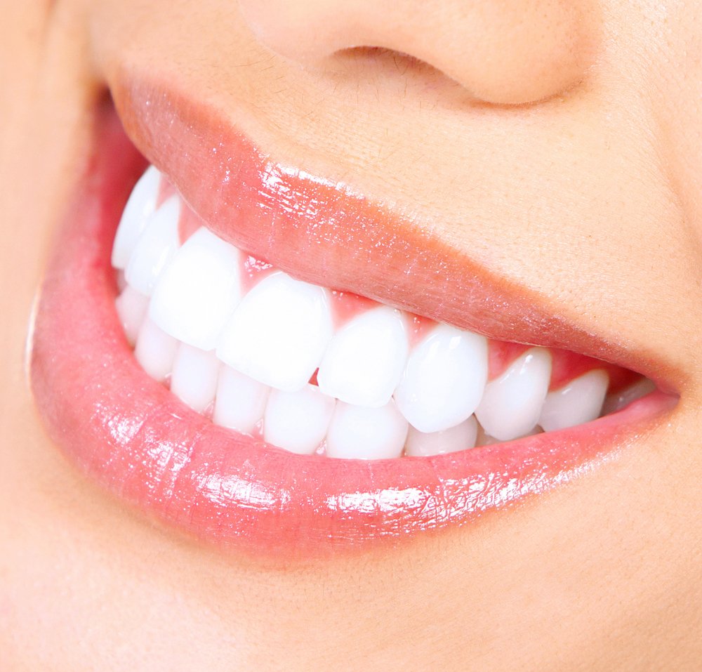 Professional Teeth Whitening Kit for Home Use - 8 Syringes of 22% Carbamide Peroxide Whitening Gel, Custom Mouth Trays & Shade Guide - Brighten Smile for Weddings, Photos & Special Events