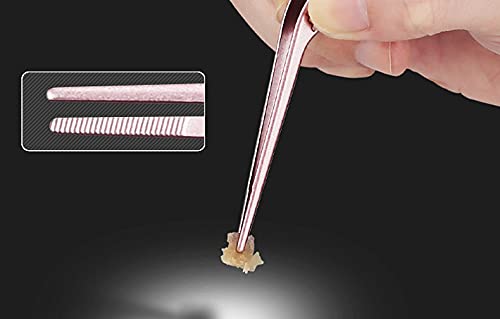 WOIWO 1PC Kids Ear Wax Removal Tool Set - Luminous Ear Pick Tweezers & Spoon for Safe Ear Cleaning (Rose Gold) | Gentle Ear Care for Children & Toddlers at Home