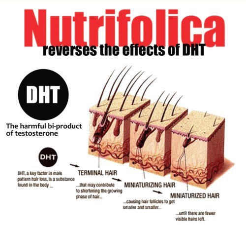 Nutrifolica Natural Hair Loss Treatment for Women & Men - Free Shampoo Included | DHT Blocker for Thicker Hair Growth | Best for Thinning Hair & Scalp Care | Perfect for Daily Use at Home & Salon
