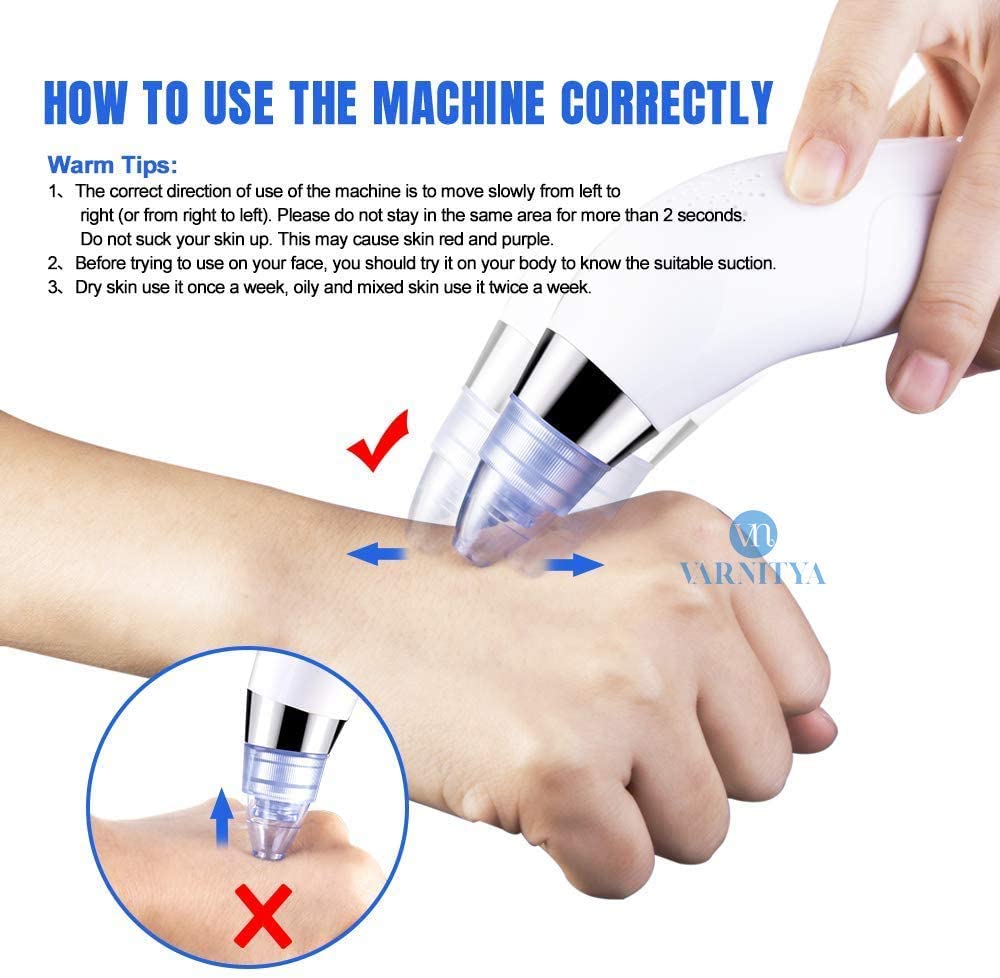Vyoma Professional Acne Pore Cleaner & Blackhead Remover Kit - Skin Care Vacuum Tool for Pimple & Blemish Removal - Perfect for Home Spa & Facial Care (Blue)