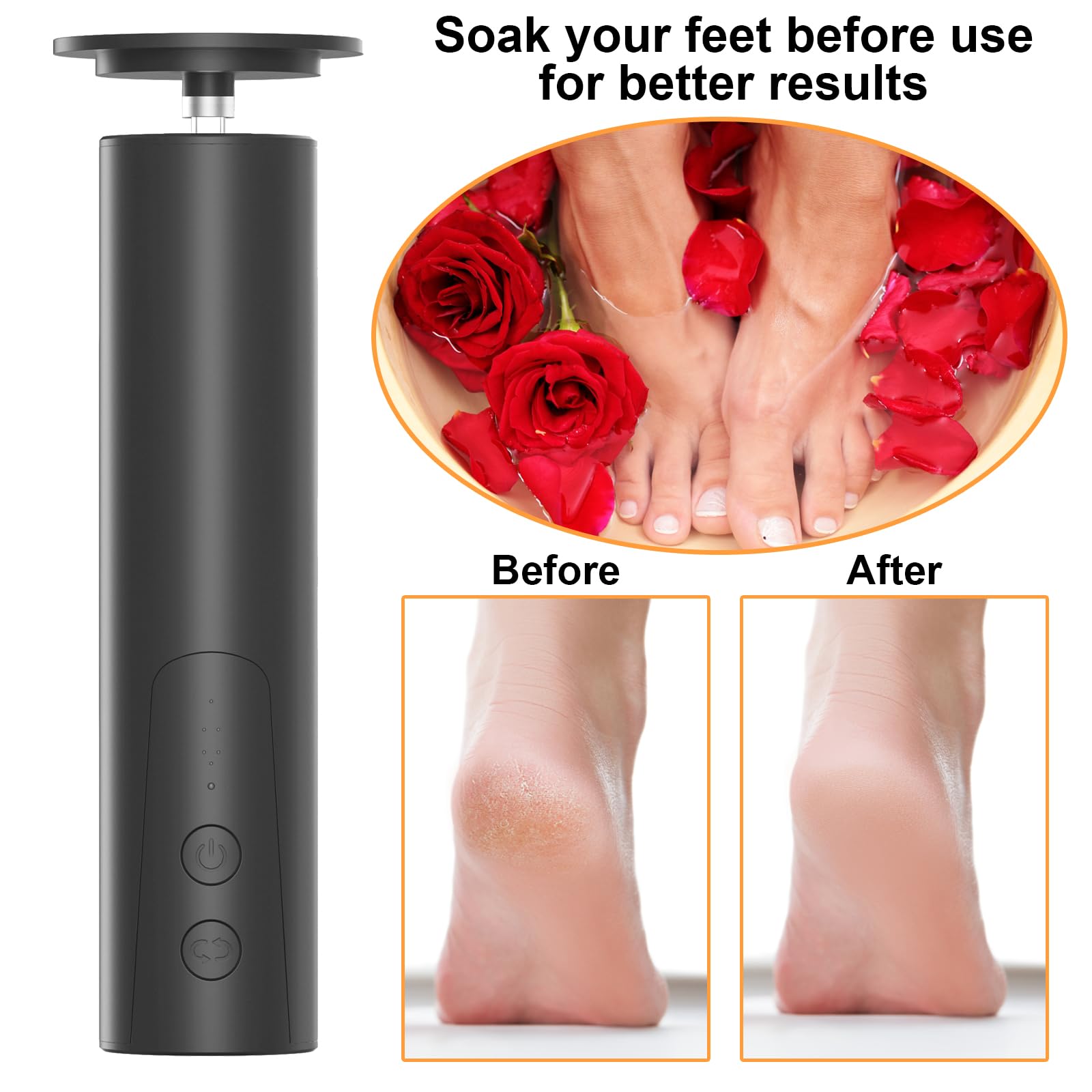 ELEOPTION Electric Callus Remover for Feet - 6 Speed Adjustable Rechargeable Foot File & Nail Grinder - Professional Pedicure Tool for Dry Dead Skin Removal - Perfect for Home Spa, Foot Care & Pedicure (Black)