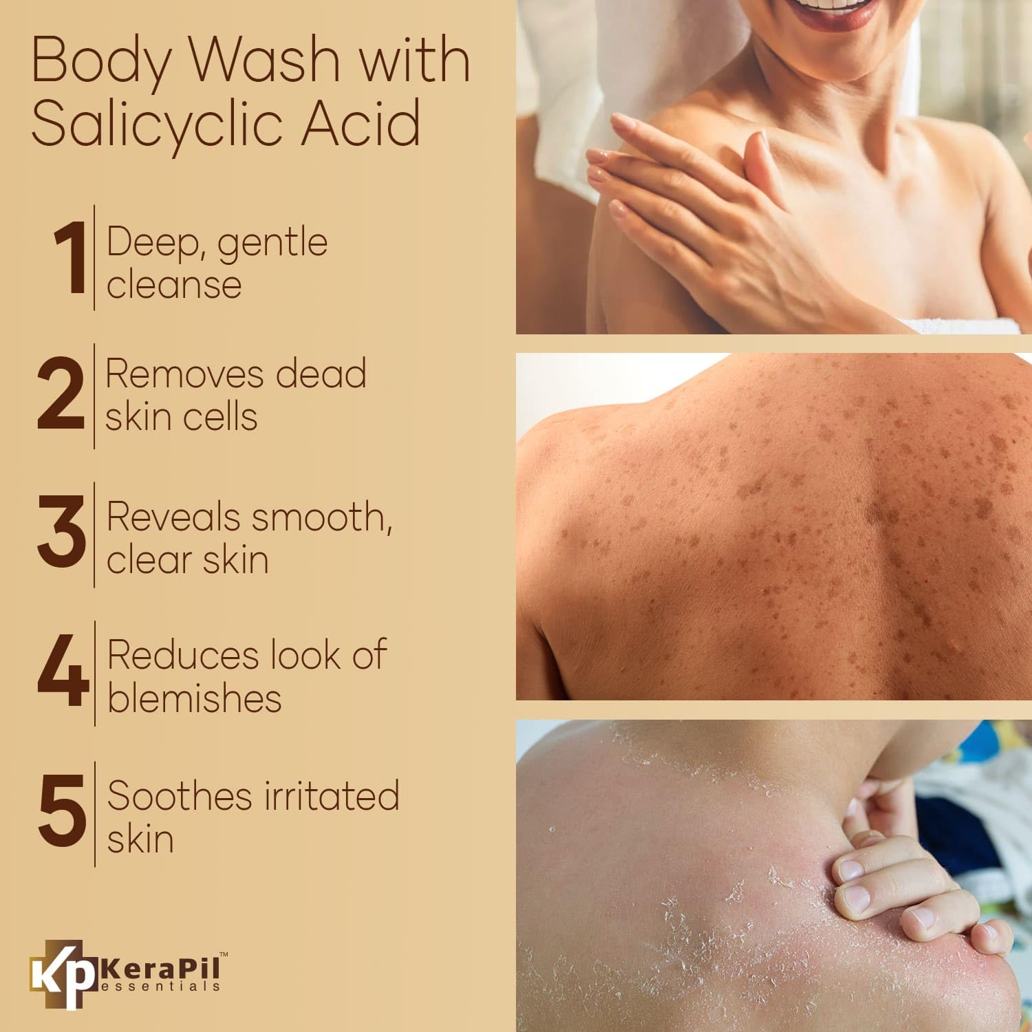 Exfoliating Body Wash with Salicylic Acid for Rough & Bumpy Skin - Gentle BHA & AHA Acne Treatment Body Wash - Coconut Vanilla Scent - Hydrating Formula Prevents Dryness - 16 fl oz x 2 Pack - Perfect for Shower, Post-Workout, and Sensitive Skin Care