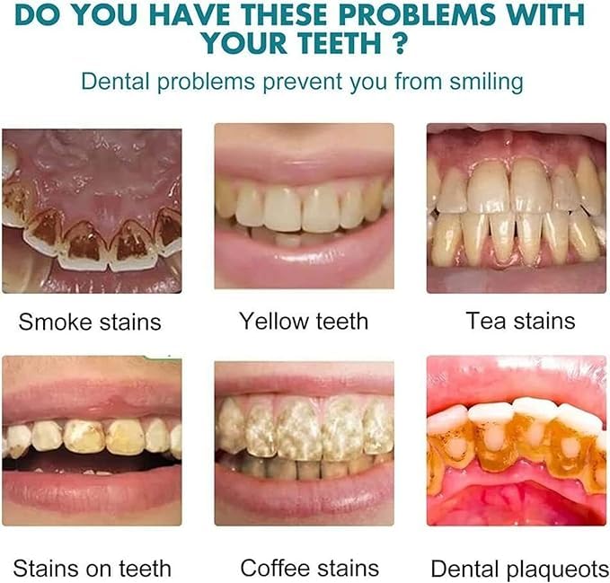 Instant Teeth Whitening Paint - Enamel Safe Whitening Gel & Polish for Brighter Smile | At-Home Teeth Whitening Solution for Daily Use & Special Occasions (1 Pack)