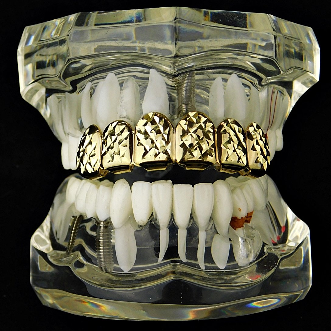 14K Gold Plated Hip Hop Grillz - Diamond Cut Upper Top 6 Teeth for Men & Women | Perfect for Rap Performances, Music Videos & Street Fashion