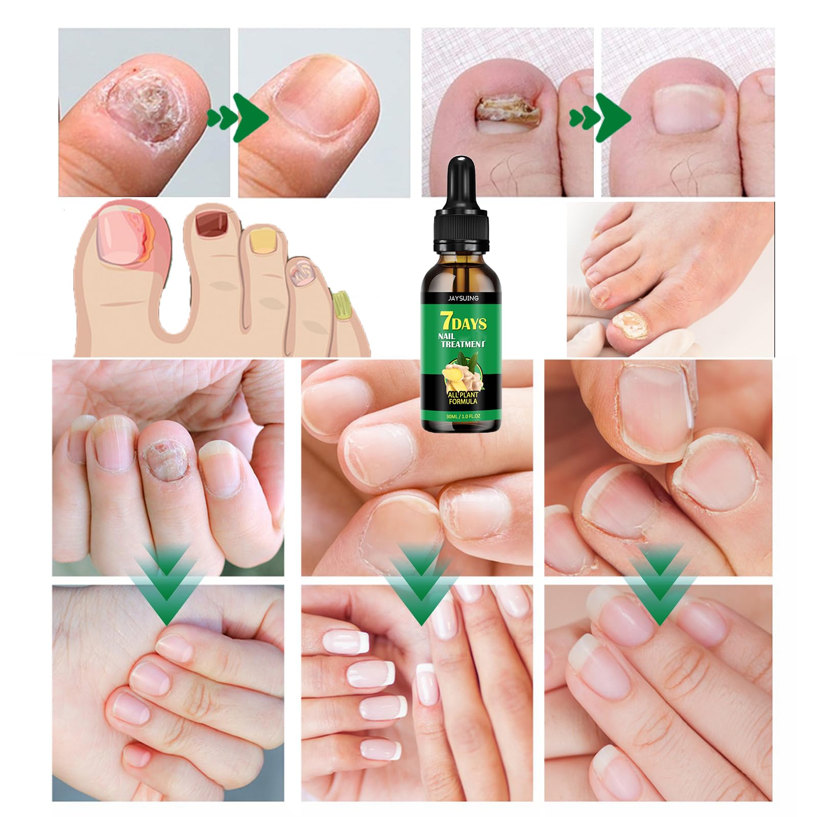 Ginger Nail Treatment & Growth Serum - 7-Day Nail Care Solution with Cuticle Oil for Stronger, Healthier Nails (3-Piece Set, 1 Fl.oz) - Perfect for At-Home Manicures & Nail Repair