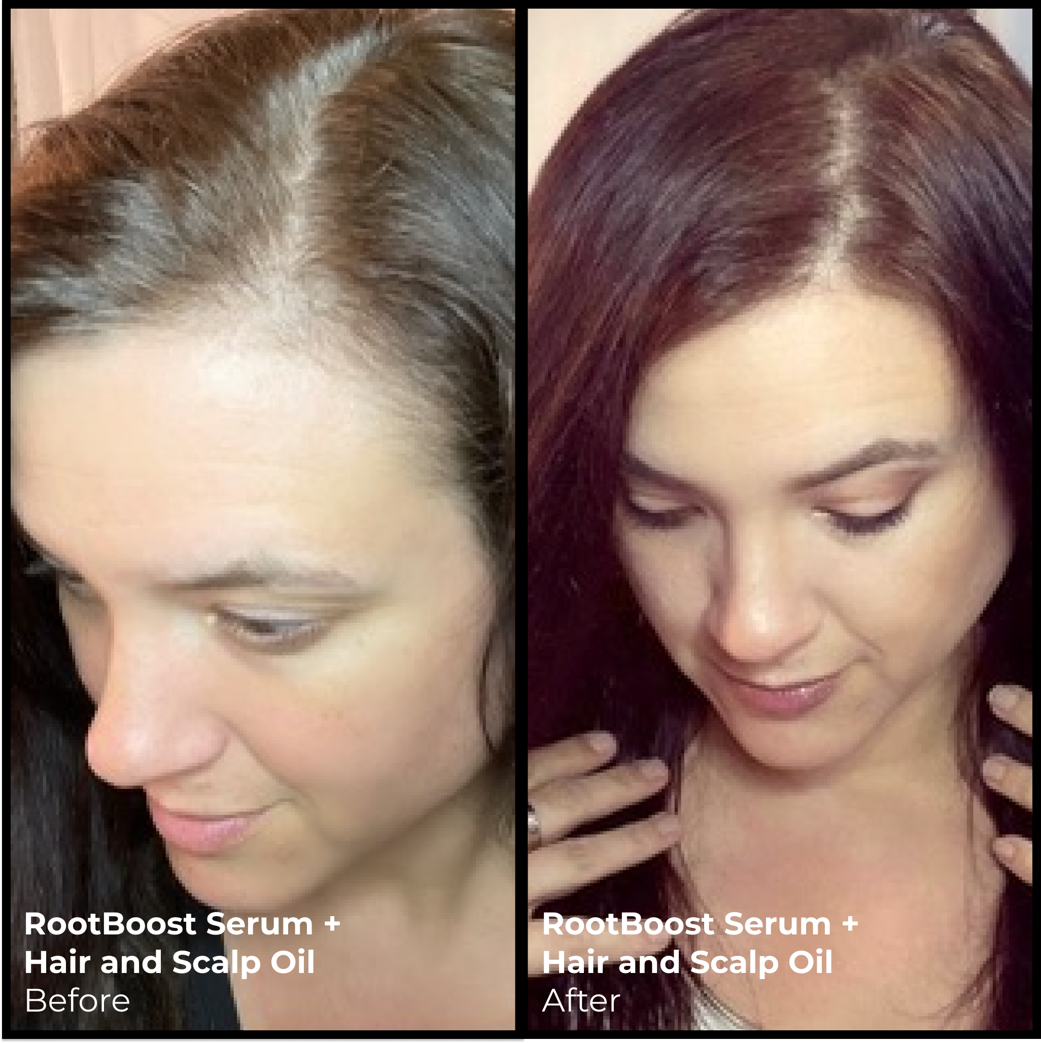 Better Roots Scalp & Hair Oil for Growth & Shine - Natural Hair Care Treatment for Dry Scalp & Damaged Hair - Perfect for Daily Use & Styling